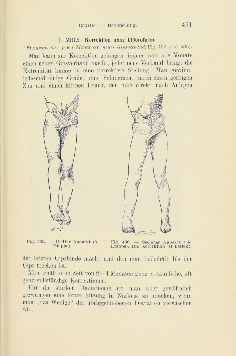 1. Mittel: Korrekfon ohne Chloroform. ( Elappenweise : jeclen Monat ein neuer Gipsverband. Fis:. 432 und 436). Man kann zur Korrektion gelangen, indem man aile Monate einen neuen Gipsverband macht, jeder neue Yerband bringt die Extremitât immer in eine korrektere Stellnng. Man gewinnt jedesmal einige Grade, ohne Schmerzen, durch einen geringen Zug und einen klcinen Druck, Fig. 435. — Dritter Apparat (3. Etappe). den man direkt naeh Anlegen Fig. 436. — Sechster Apparat ( 6. Etappe). Die Korrektion ist perfekt. der letzten Gipsbinde macht und den man beibehalt bis der Gips trocken ist. Man erhalt so in Zeit von 2—4 Monaten ganz erstaunliche, oft ganz vollstandige Korrektionen. kür die starkcn Deviationen ist man aber gewôhnlich gezwungen eine letzte Sitzung in Narkose zu machen, wenn man ,,das Wenige“ der übriggebliebenen Déviation verwischen will.