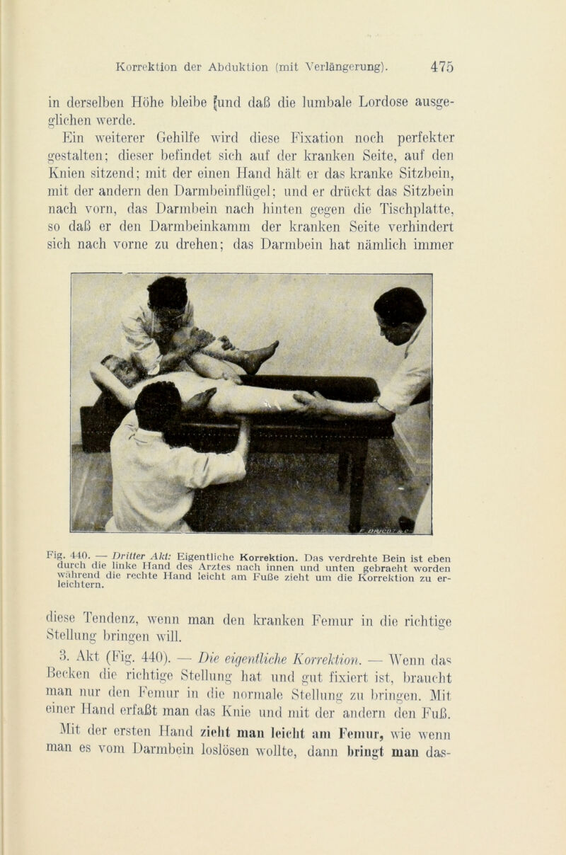 in derselben Hôhe bleibe (und daB die lumbale Lordose ausge- glichen werde. Ein weiterer Gehilfe wird diese Fixation noch perfekter gestalten; dieser befindet sich auf der kranken Seite, anf den Knien sitzend; mit der einen Hand hait er das kranke Sitzbein, mit der andern den Darmbeinflügel ; und er drückt das Sitzbein nach vorn, das Darmbein nach hinten gegen die Tischplatte, so daB er den Darmbeinkamm der kranken Seite verhindert sich nach vorne zu drehen; das Darmbein hat nâmlich immer r-ig. 440. — Dritter Akt: Eigen Niche Korrektion. Das verdrehte Bein ist eben durcn die linke Hand des Arztes nach innen und unten gebraeht worden wn h rend die redite Hand leicht am FuI3e zieht uni die Korrektion zu er- leichtern. diese Fendenz, wenn man den kranken Fémur in die richtige Stellung bringen will. B. Akt (Fig. 440). — Die eigentliche Korrektion. — Wenn das Bocken die richtige Stellung hat und gut fixiert, ist, brandit man nur den hemur in die normale Stellung zu bringen. Mit einer Hand erfaBt man das Knie und mit der andern den FuB. Mit der ersten Hand zieht man leicht am Fémur, wie wenn man es vom Darmbein loslosen wollte, dann bringt man das-