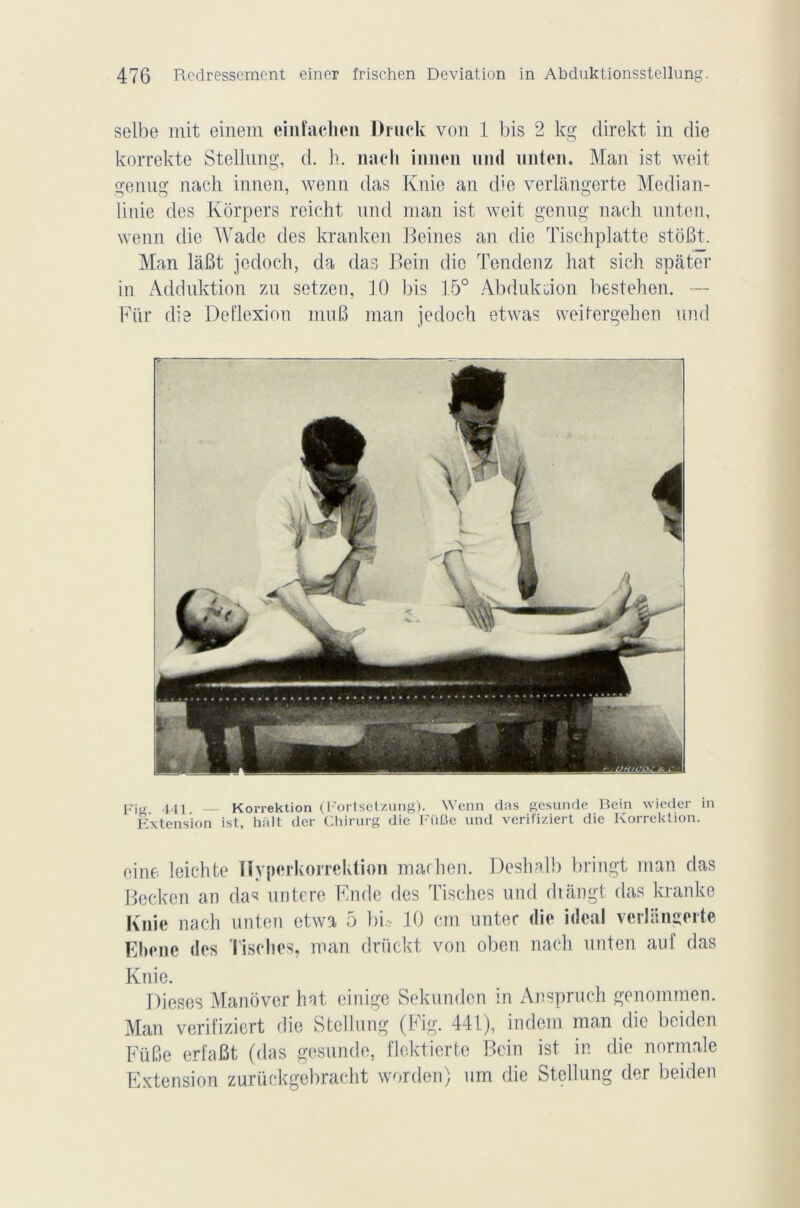 selbe mit einem einfachen Druck von 1 bis 2 kg direkt in die korrekte Stellung, d. h. nacli innen nnd imten. Man ist weit genng nach innen, wenn das Knie an die verlângerte Median- linie des Kôrpers reicht nnd man ist weit genng nach nnten, wenn die Wade des kranken Beines an die Tischplatte stoBt. Man lâBt jedoch, da das Bein die Tendenz hat sich spàter in Adduktion zu setzen, JO bis 15° Abdukdon bestehen. — Fiir die Deflexion muB man jedoch etwas weitergehen nnd pj<r 44i Korrektion (Fortsetzung). Wenn das gesunde Bein wieder in Extension ist, hait der Chirurg die FüCe und verifiziert die Korrektion. eine leichte ïlvperkorrektion machen. Deshalb bringt man das Becken an da^ untere Ende des Tisches und diângt das kranke Knîe nach nnten etwa 5 b U 10 cm unter (lie idéal verlângerte Ebene (les Tisches, man drückt von oben nach nnten auf das Knie. Dieses Manover hat einige Sekunden in Ansprnch genommen. Man verifiziert (lie Stellung (big. 441), indem man die beiden FüBe erfaBt (das gesunde, flektierte Bein ist in die normale Elxtension zurückgebracht worden) nm die Stellung der beiden