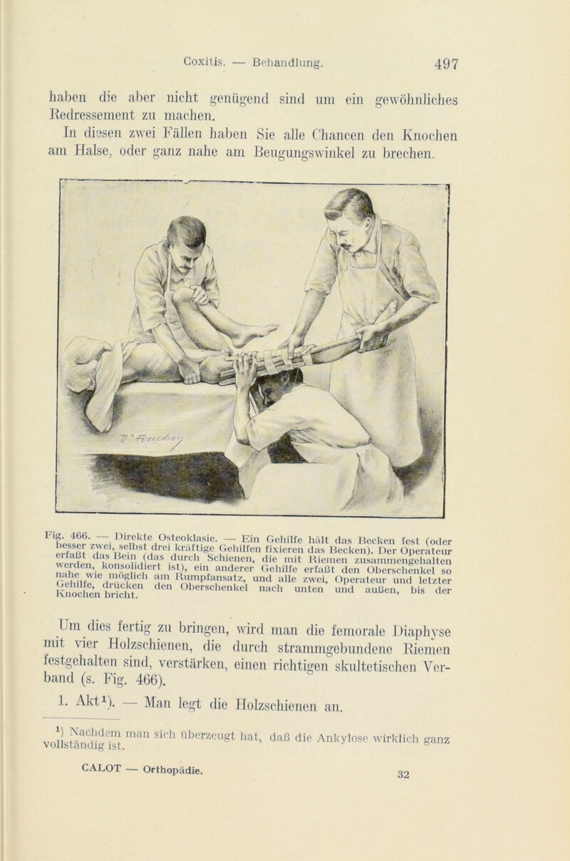 haben die aber nicht genügend sind uni ein gewohnlich.es Redressement zu machen. In diesen zwei Fâllen haben Sie aile Chancen den Knochen ain Halse, oder ganz nahe am Beugiingswinkel zu breehen. FDli;®kle °ste°klasie. — Ein Gehilfe hait das Beclten test (oder erl'aRt idrei ,kr£dtlg® Gehilfen fixieren das Becken). Der Operateur werden i n inîi rd£lS darch. Schienen, die mit Biemen zusammengehalten nahp w^k^ml di 1 1SR’ einr anderer Gehilfe erfaBt den Oberschenkel so Gehüfe rlHipÆ1 aim IF‘,mpfa1usafz’ und alle zwei. Operateur und letzter KnocheFbricht d °berschenkel nach unten und auüen, bis der Um dies fertig zu bringen, wird man die fémorale Diaphyse mit vier Holzschienen, die durch strammgebundene Riemen festgehalten sind, verstarken, einen richtigen skultetischen Ver- band (s. Fig. 466). 1. Akt1). Man legt die Holzschienen an. vollsUindiTsL maü llkerzeugt hat, dafi die Ankylosé wirklich ganz CALOT — Orthopâdie. 32
