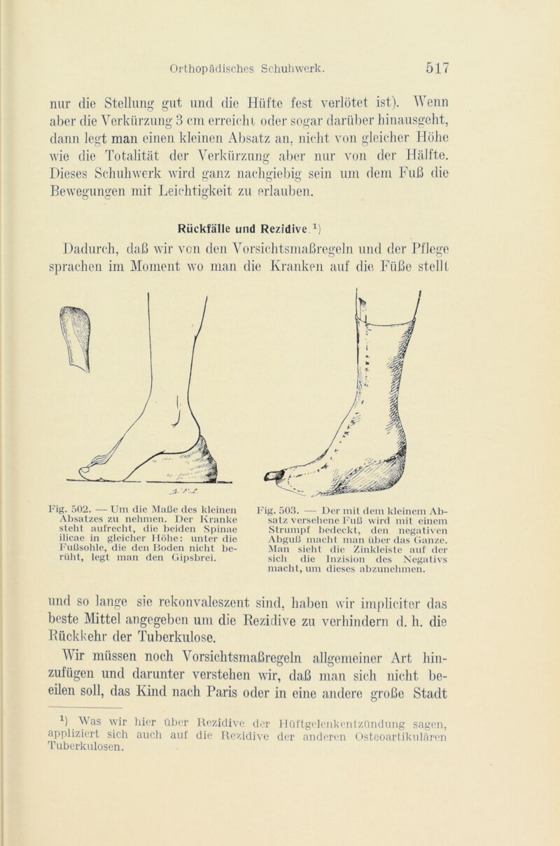 nur die Stellung gut und die Hiifte fest verlotet ist). Wenn aber die Verkürzung 3 cm erreich t oder sogar darüber hinausgeht, dann legt man einen kleinen Absatz an. niclit von gleicher Holie wie die Totalitât der Verkürzung aber nnr von der Hâlfte. Dieses Schuhwerk wird ganz nachgiebig sein um dem Pub die Bewegungen mit Leichtigkeit zu erlauben. Rückfalle und Rezidive A) Dadnrch, daB wir von den VorsichtsmaBregeln und der Pflege sprachen im Moment wo man die Kranken auf die FiiBe stellt Fig. 502. — Um die MaBe des kleinen Absatzes zu nehmen. Der Kranke steht aufrecht, die beiden Spinae ilicae in gleicher Hôhe: unter die FuBsohle, die den Boden niclit be- rüht, legt man den Gipsbrei. Fig. 503. -— Der mit dem kleinem Ab- salz verseliene FuÜ wird mit einem Strumpf bedeckt, den negativen AbguB macht man liber das Ganze. Man sicht die Zinkleiste auf der sicb die Inzision des Negativs macht, um dieses abzunehmen. nnd so lange sie rekonvaleszent sind, liaben wir impliciter das beste Mittel angegeben um die Rezidive zu verhindern d. h. die Rückkehr der Tuberkulose. Wir müssen noch VorsichtsmaBregeln allgemeiner Art liin- zufügen und darunter verstehen wir, daB man sich niclit be- eilen soll, das Kind nach Paris oder in eine andere groBe Stadt P Was wir hier übcr Rezidive der Hüftgelenkentzündung sagen, appliziert sich auch auf die Rezidive der anderen Osteoartikularen Tuberkulosen.