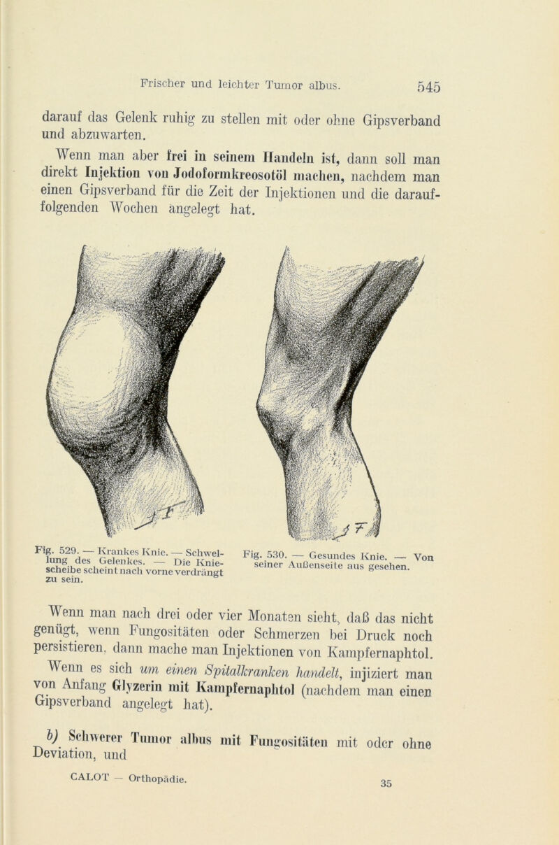 Frischer und leichter Tumor albus. darauf das Gelenk ruhig zu stellen mit oder ohne Gipsverband und abzuwarten. Wenn man aber frei in seinem Handeln ist, dann soll man direkt Injektiou von Jodoformkreosotol machen, nachdem inan einen Gipsverband für die Zeit der Injektionen und die darauf- folgenden Wochen angelegt liât. Fig. 529. — Kranl <es Knie. — Schwel- lung des Gelenkes. — Die Knie- scheibe scheint nach vorne verdrangt zu sein. Fig. 530. — Gesundes Knie. — Von seiner AuBenseite aus gesehen. Wenn man nach drei oder vier Monaten sieht, dafi das nicht genügt, wenn Fungositàten oder Schmerzen bei Druck noch persistieren, dann mâche man Injektionen von Kampfemaphtol. Wenn es sich um einen Spitalkranken handelt, injiziert man von Anfang Glyzerin mit Kampfernapkto] (nachdem man einen Gipsverband angelegt hat). b) Schnerer Tumor alhus mit Fungositàten mit oder ohne Déviation, und CALOT — Orthopâdie. o?