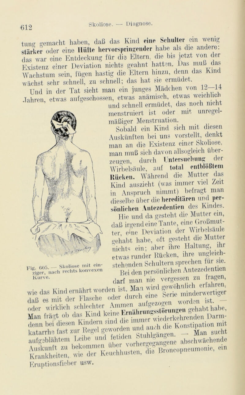 Slcoliose. Diagnose. tuno- o-emacht haben, dab das Kind eine Schulter ein wenig Stacker oder eine lliiïte hervorspringender liabe als die andere: das war eine Entdeckung fur die Elterm die bis jetzt von der Existenz einer Déviation nichts geahnt hatten Das mub cas Wachstum sein, fügen hastig die Eltern hinzu, demi das Kmc wachst sehr schnell, zu schnell; das liât sie ermudet. Und in der Tat sieht man ein jutiges Mâdchen von K -E Jahren, etwas aufgeschossen, etwas anâmisch, etwas weiclilich und schnell ermüdet, das noch mcht menstruiert ist oder mit umegel- mabiger Menstruation. Sobald ein Kind sich mit diesen Auskünften bei uns vorstellt, clenkt man an die Existenz einer Skoliose. man mub sich davon allsogleich über- zeugen, durch Untersuclmng der Wirbelsaule, auf total entbloBtem Kiieken. Wahrend die Mutter das Kind auszieht (was immer viel Zeit in Anspruch nimmt) befragt man dieselbe über die hereditaren und per- sônlichen Antezcdentien des Kindes. Hie und da gesteht die Mutter ein, dab irgend eine Tante, eine Grobmut- tcr eme Déviation der M irbelsâule o-ohabt habe, oft gesteht die Mutter nichts ein; aber ihre Haltung, mr etwas runder Rücken, ihre ungleich- stehenden Schultern sprechen fur sie. Bei den personlichen Antezedentien darf man nie vergessen zu fragen, ™ d. KM M •> , SKiSS katarrhe fast zur Hegel gewoi den u , , ' _ Man sucht u.ljpUihM» Mb. “SJ ; ,b»b.Kh..d. “ïï“,î STtSiSÆ» Eruptionsfieber usw. Fig 605. — Skoliose mit cin- figer, nach rechts konvexen Kurve.