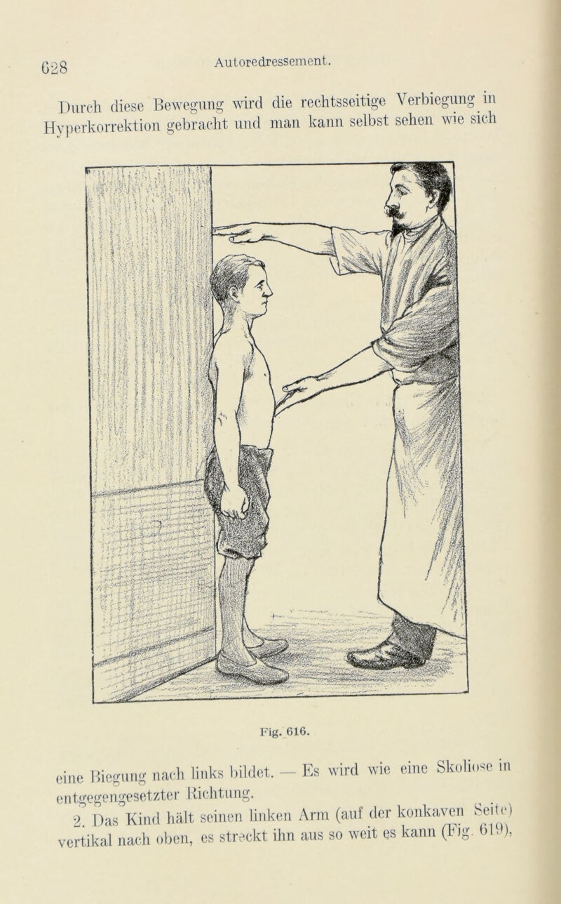 G28 Autoredressement Durch diese Bewegung wird die rechtsseitige Verbiegung m Hyperkorrektion gebracht und man kann selbst sehen wie sich Fig. 616. cine Biegung nach links bildet. - Es wird wie eine Skoliose in ento-egengesetzter Richtung. 2. Das Kind hait seinen linken Arm (auf der konkaven Seitei vertikal nach oben, es streckt ihn aus so weit es kann (Fig. 619),