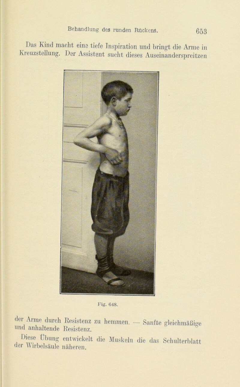 Behandlung des runden RückenS. 053 Das Ivincl inacht eine tiefe Inspiration und bringt die Arme in Kreuzstellung. Der Assistent sucht dieses Auseinanderspreitzen Fig. 648. der Arme durch Resistenz zu hemmen. — Sanfte gleichmâbi™ nnd anhaltende Resistenz. Diese Ubung entwickelt die Muskeln die das Schulterblatt der W îrbelsâule nàheren.