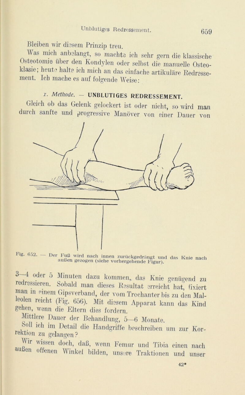 Unblutiges Redressement. Bleiben wir diesem Prinzip treu. W as mich anbelangt, so machta ich sehr gern die klassische Ostéotomie über den Kondylen oder selbst die manuelle Osteo- klasie; heute halte ich mich an das einfache artikulâre Redresse- ment. Ich mâche es auf folgende Weise: J. Méthode. — UNBLUTIGES REDRESSEMENT. Gleich ob das Gelenk gelockert ist oder nieht, so wird man durch sanfte und progressive Manover von einer Dauer von Fig. Der LuB wird nach innen zurückgedrangt und das auUen gezogen (sielie vorhergehende Figur). Knie nach 3 4 oder 5 Minufcen dazu kommen,. das Knie genügend zu redressteren. Sobald man dieses Résultat srreicht hat fhiert man in emem Gipsverband, der vom Trochanter bis zu den Mal- leolen reicht (Fig. 656). Mit dissent Apparat kann das Kind genou, wenn die Eltern dies fordern. Mittlcre Dauer der Behandlung, 5—6 Monate. . ? m) Detail die Handgriffc beschreiben um zur K or- reivtion zu gelangen ? ^ii wissen doch, daB, wenn Fémur und Tibia einen nach auben offenen Winkel bilden, unsere Traktionen und miser 42*