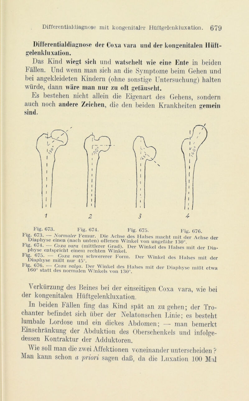 Differentialdiagnose der Goxa vara und der kongenitalen lliiït- gelenkluxation. Das Kind wiegt sicli und watsclielt wie eine Ente in beiden Fàllen. Und wenn man sich an die Symptôme beim Gehen und bei angekleideten Kindern (ohne sonstige Untersuchung) halten würde, dann wàre man nur zu oft getàuscht. Es bestehen nicht allein die Eigenart des Geliens, sondern aucli noch andere Zeiclien, die den beiden Krankheiten gemein sind. Fig. 673. Fig. 674. Fig. 675. Fig. 676. Idg. 673. Normaler Fémur. Die Achse des Halses macht mit der Achse der Diapnyse einen (nach unten) olfenen Winkel von ungefalir 130°. Fig 674. — Coxa vara (mittlerer Grad). Der Winkel des Halses mit der Dia- physe entspricht emem rechten Winkel. F%ia6p7hÿsrmiBnu^5“.SChWererer ^ Der Winkcl des Halses mit F*160^ statt (n^normalen^Wn^^ 130^.a'SGS dCr Diai>hySC miBt etwa Verkürzung des Beines bei der einseitigen Coxa vara, wie bei der kongenitalen Hüftgelenkluxation. In beiden Fallen fing das Kind spat an zu gehen; der Tro- chanter befindet sich über der Nelatonschen Finie; es besteht lumbale Lordose und ein clickes Abdomen; —- man bemerkt Einschrânkung der Abduktion des Oberschenkels und iufolge- dessen Kontraktur der Adduktoren. Wie soll man die zwei Affektionen voneinander unterscheiden ? Man kann schon a priori sagen daB, da die Luxation 100 Mal