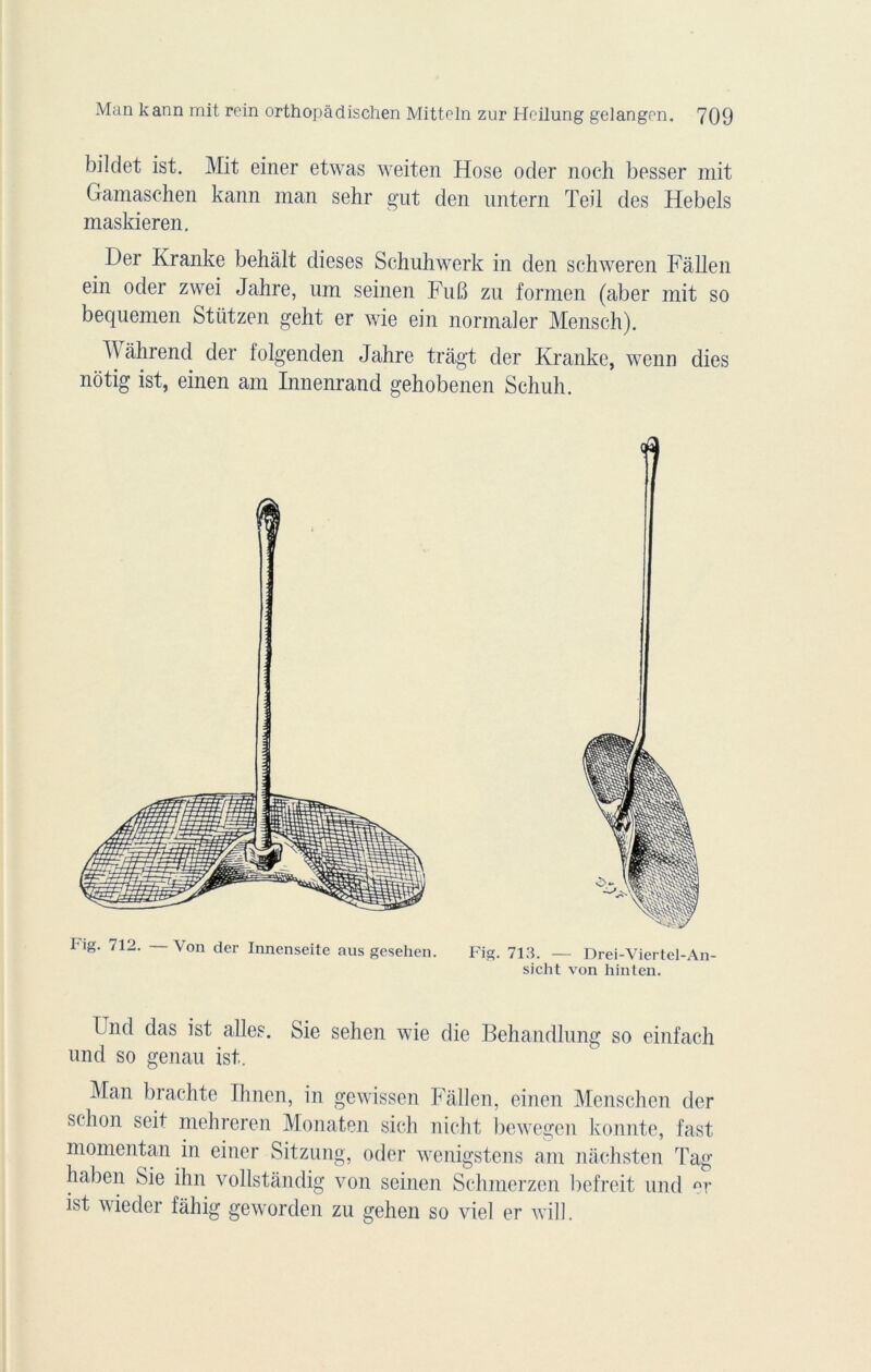 bildet ist. Mit einer etwas weiten Hose oder noch besser mit Gamaschen kann man sein* gut den nntern Teil des Hebels maskieren. Der Kranke behàlt dieses Schuhwerk in den schweren Fâllen ein oder zwei Jahre, uni seinen Fu6 zu formen (aber mit so beqnemen Stützen gelit er wie ein normaler Mensch). W ah rend der folgenden Jahre tragt der Kranke, wenn dies nôtig ist, einen am Innenrand gehobenen Schuh. F,g* /12, V°n der Innenseite aus gesehen. Fig. 713. — Drei-Viertel-An- sicht von hinten. knd das ist ailes. Sie sehen wie die Behandlnng so einfach nnd so genau ist. Man brachte Ihnen, in gewissen Fâllen, einen Menschen der schon seit mehreren Monaten sich nicht bewegen konnte, fast momentan in einer Sitzung, oder wenigstens am nâchsten Tag haben Sie ihn vollstândig von seinen Schmerzen befreit und er ist wieder fàhig geworden zu gehen so viel er will.