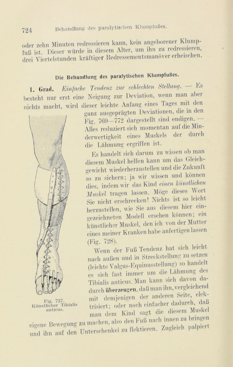 oder zehn Minuten redressieren kann, kein angeborener Klump- fufi ist Dieser würde in diesem Alter, um ihn va\ redressieren, drei Viertelstunden krâftiger Redressementsmanover erheischen. PM m '4 Die Behandlung des paralytischen Klumpîufies. I. Grad. Einfache Tendenz zur schUckten Stellung. ks besteht nur erst eine Neigung zur Déviation, wenn man aber nichts maeht, wird dieser leichte Anfang eines Tages mit tien ganz ausgeprâgten Deviationen, die m don Fig. 769—772 dargestellt sind endigen. — Ailes reduziert sich momentan au! die Min- derwertigkeit eines Muskels der dnrch die Làhmung ergriffen ist. Es handelt sich darum zu v issen ob man diesem Muskel helfen kann um das (lleicli- gewicht wiederherzustellen und die Zukunit so zu sichern; ja wir wissen und konnen dies, indem wir das Kind einen künstlichen Muskel tragen lassen. Miigc dieses Wort Sic nicht erschrecken! Nichts ist so leu-lit herzustellen, wie Sic ans diesem hier ein- o-ezeichneten Modell ersehen konnen; ein künstlicher Muskel, don ieh von der Mutter eines meiner Kranken Italie anfertigen lassen (Fig. 728). Wenn der Fut) Tendenz liât sich leieht nach auBen und in Streckstellung zusetzen (leichte Valgus-Equinusstellung) so handelt es sich fast, immer um die Lâhmung des Tibialis anticus. Man kann sich davon da- durch überzeugen, daBman ihn.vergleichend mit dcmjenigen der anderen Seite c c y trisiert; oder noch einfacher dadurch, dal. man dem Kind sagt die diesem Muskel eioene Bewegung zu machen, also den FuB nach innen zu brmgen Fig. 727. Künstlicher r\ ibialis anticus.