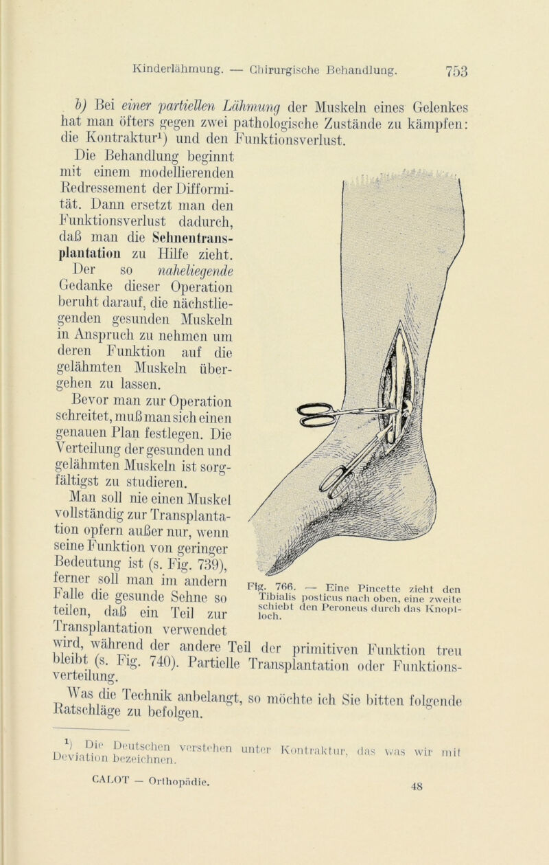 1)) Bei einer partiellen Làhmung cler Muskeln eines Gelenkes liât man ofters gegen zwei pathologische Zustânde zu kàmpfen: die Kontraktur1) und den Funktionsverlust. Die Behandlung beginnt mit einem modellierenden Redressement der Difformi- tàt. Dann ersetzt man den Funktionsverlust dadurch, daB man die Selinentrans- plantation zu Hilfe zielit. Der so naheliegende Gedanke dieser Operation beruht darauf, die nâchstlie- genden gesunden Muskeln in Anspruch zu nehmen uni deren Funktion auf die gelâhmten Muskeln iiber- gehen zu lassen. Bevor man zur Operation schreitet, muB man sich einen genauen Plan festlegen. Die Verteilung der gesunden und gelâhmten Muskeln ist sorg- fâltigst zu studieren. Man soll nie einen Muskel vollstândig zur Transplanta- tion opfern auBer nur, wenn seine Funktion von geringer Bedeutung ist (s. Fig. 739), ferner soll man im andern F}„ p. .. . ,, . tt'„ 11 j* ^ îoi 1 Vr!.. /bb> — Eine Pincette zieht den Edile aie gesunde behne SO Tibialis posticus nach oben, eine zweite teilen, daB ein Teil zur £ebt den Peroneus durch das Knoi)1‘ Transplantation verwendet mrd wâhrend der andere Teil der primitiven Funktion treu bleibt (s. Fig. 740). Partielle Transplantation oder Funktions- verteilumr. Was die Ratschlâge lechnik anbelangt, so mochte ich Sie bitten folgende zu befolgen. XJ Die Deutsehen verstehen unter Déviation bczeichnen. Kontraktur, das was wir mit CALOT — Orlhopâdie. 48