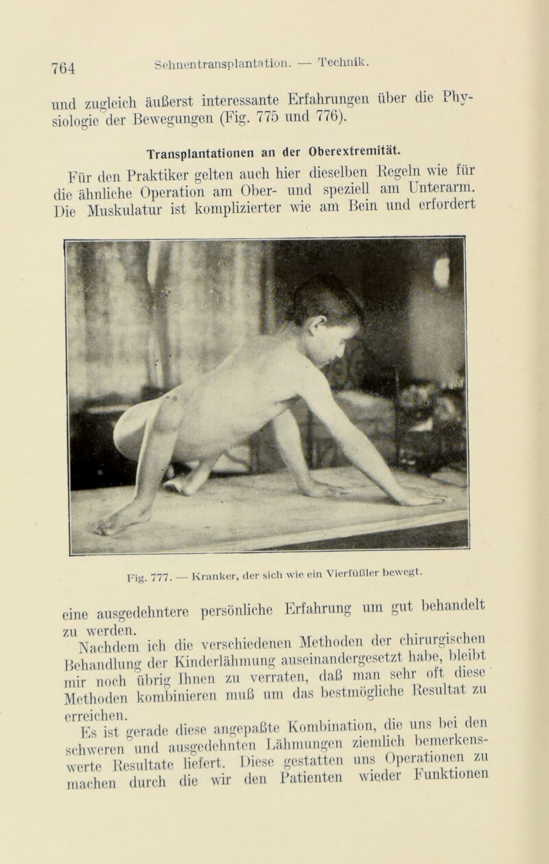 imd zugleich auBerst intéressante Erfahrnngen liber die Phy- siologie der Bewegungen (Fig. 775 nnd 776). Transplantationen an der Oberextremitàt. Fiir den Praktiker gelten an eh hier dieselben Regel n wie für die âhnliche Operation am Ober- und speziell am Unterarm. Die Mnsknlatur ist komplizierter wie am Bein und erfordert Fig. 777. _ Kranker, dor sich wie ein VierlüBler bewegt. eine ausgedehntcre pcrsônliche Erfahrung uni gut behandelt Nachdem ich die verschiedenen Methoden der chirnrgisehen Behandlung der Kinderlâhmung auseinandergesetzt habe, bleil>t mir noch übrig Ihnen zu verraten, dafi man sehr oft diese Methoden kombinieren mu8 um das bestmôghche Résultat zu CrlEs ist gerade diese angepafite Kombination, die uns bel den schweren und ausgedchnten Lâhmungen ziemhch bemerkens- werte Resultate lictert. Diese gestatten uns Operationcn zu maehen durch die wir den Pationten wieder hunktionen