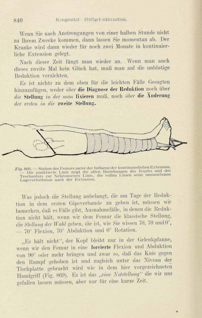 Wenn Sie nach Anstrengungen von einer halben Stunde nicht zu Ihrem Zweeke kommen, dann lassen Sie momentan ab. Der Kranke wird dann wieder für noch zwei Monate in kontinuier- liche Extension gelegt. Nach dieser Zeit fângt inan wieder an. Wenn man auch dieses zweite Mal kein Gluck liât, mu B man auf die nnbllitige Reduktion verzichten. Es ist nichts zn dem oben für die leichten Fâlle Gesagten hinzuzufiigen, weder iïbey die Diagnose der Reduktion noch liber die Stellung in der man fixieren mu B, noch iïber die Ânderung der ersten in die zweite Stellung. _FW 8B(5 — Sinken des Fémurs unter der Influenz der kontinuierlichen I.x tension. — nie punktierte Finie zcigt die alten Beziehungen des Koples uncl des Trochanters zur Nelatonschen Finie, die vollen Finien seine momentanen Lageverhaltnisse nach der Kxtension. Was je do ch die Stellung anbelangt, die am Tage der Reduk- tion in dem ersten Gipsverbande zu geben ist, müssen wir bemerken, daB es Fallegibt, Ausnahmefalle, in denen die Reduk- tion nicht hait, wenn wir dem Fémur die klassische Stellung, die Stellung der Wahl geben, die ist, wie Sie wissen 70, 70 und0°, — 70° Flexion, 70° Abduktion und 0° Rotation. ,,Es hait nichtu, der Kopf bleibt nur in der Gelenkpfanne, wenn wir den Fémur in eine îoreierte Flexion und Abduktion von 90° oder mehr bringen und zwar so, daB das Knie gegen den Rumpf gehoben ist und zugleich unter das Niveau der Tischplatte gebracht wird wie in dem hier vorgezeichneten Handgriff (Fig. 869). Es ist das „eine Notstelluncgu die wir uns o-efallen lassen müssen, aber nur für eine kurze Zeit. O