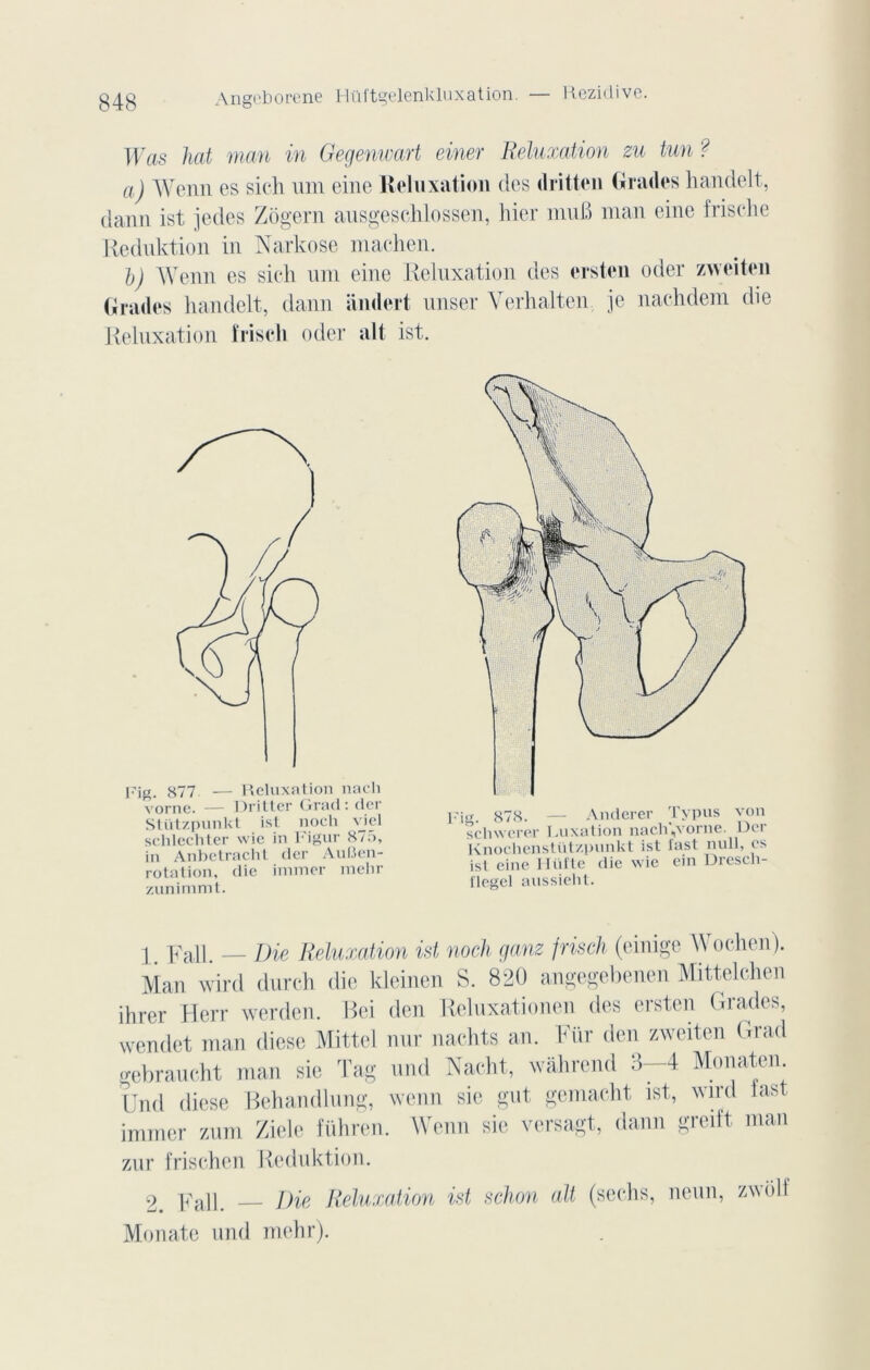 Was hat man in Gegenwart einer Reluxation zu tun ? a) Wenn es sich um eine Keluxation des dritten Grades handelt, daim ist jedes Zôgern ausgeschlossen, hier muB man eine frische Keduktion in Narkose machen. b) Wenn es sich uni eine Relnxation des ersten oder zweiten Grades handelt, dann iimlert unser Yerhalten je nachdem die Relnxation iïiscli oder ait ist. Fig. 877 — Reluxation nacli vorne. — Dritter Grad: der Stützpunkt ist noch viel schlechter wie in Figur 875, in Anbetracht der AuBen- rotation, die immer mebr zunimmt. pig, 878. — Anderer Typus von schwerer Luxation nachjvorne. Der Knochenstützpunkt ist fast null, es ist eine Hüfte die wie ein Drescn- flegel anssieht. 1. F ail. — Die Reluxation ist noch ganz frisch (einige Wochen). Man wird durch die kleinen S. 820 angegebenen Mittelchen ihrer Herr werden. Bei den Reluxationen des ersten Grades, wcndet man dicse Mittel nur nachts an. Für den zweiten Grad gebraucht man sic Tag und Nacht, wâhrend 3-4 Monatcn. Und diese Behandlung, wenn sic gut gemacht ist, wird fast immer zum Ziele führen. Wenn sie versagt, dann greift man zur frischen Keduktion. Fall. Die Reluxation ist schon ait (sechs, neun, zwolf Monate und mehr).