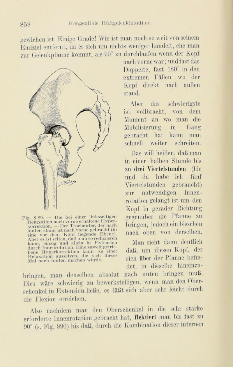 gewichen ist. Einige Grade! Wie ist man noch so weit vonseuiem Endziel entfernt, da es sich um nichts weniger handelt, ehe man zur Gelenkpfanne kommt, als 90° zu durchlaufen wenn der Kopf nach vorne war ; und fast das Fig. 8 89. — Die bei einer linksseitigen Reluxation nach vorne erlialtene Hyper- korrektion. —Der Trochanter, der nach hinten stand isl nach vorne gebracht (in eine vor dem Kopf liegende Ebene). Aber es ist selten, daC man so reduzieren kann, einzig und allein in Extension durcli Innenrotation. Kine zuweit gelrie- bene Hyperkorrektion kann zu einer Reluxation aussetzen, die sicli dieses Mal nach hinten machen würde. Doppelte, fast 180° in den extremen Fallen wo der Kopf direkt nach auBen stand. Aber das schwierigste ist vollbracht, von dem Moment an wo man die Mobilisierung in Gang gebracht liât kann man schnell weiter schreiten. Das will heiBen, daB man in einer halben Stunde bis zn drei Yiertelstimden (hie und da habe ich fünf Yiertelstunden gebraucht) zur notwendigen Innen- rotation gelangt ist um den Kopf in gcradcr Richtung gegeniiber die Pfanne zu bringen, jedoch einbisschen nach oben von derselben. Man sieht dann deutlich daB, um diesen Kopf, der sich iiber der Pfanne befin- det, in dieselbe hinemzu- bringen, man denselben absolut nach unten bringen muB. Pies ware schwierig zu bewerkstelligen, wenn man den Ober- schenkel in Extension lieBe, es làBt sich aber sehr leicht durch die Flexion erreichen. Also nachdem man den Oberschenkel in die sehr starke erforderte Innenrotation gebracht liât, flcktiert man l)is fast zu 90° (s. Fig. 890) bis daB, durch die Kombination dieser internen