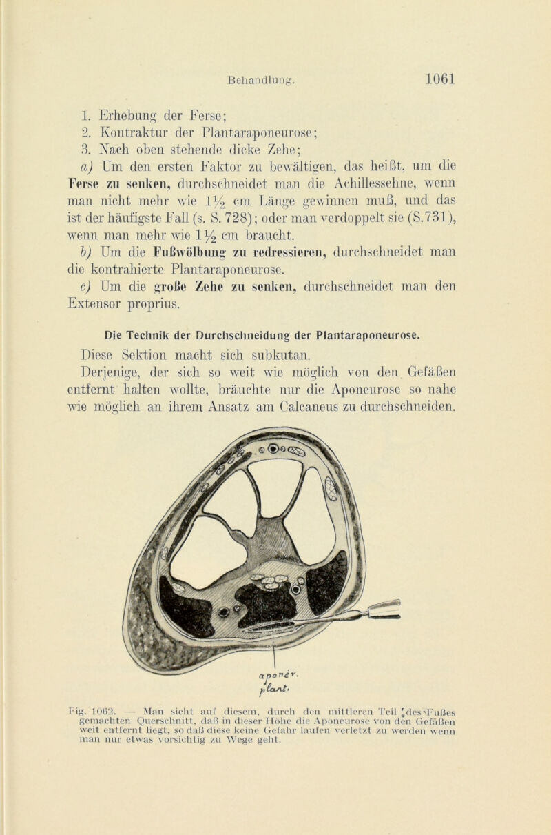 1. Erhebung der Ferse; 2. Kontraktur der Plantaraponeurose; 3. Nach oben stehende dicke Zehe; a) Um den ersten Faktor zu bewâltigen, das heiBt, um die Ferse zu senken, durchschneidet man die Achillessehne, wenn nian nicht mehr wie 1 y2 cm Lange géwinnen 111116, und das ist der hàufigste Fall (s. S. 728) ; oder man verdoppelt sic (S.731), wenn man mehr wie 1 y2 cm braucht. b) Um die Fufiwolbung zu redressiercn, durchschneidet man die kontrahierte Plantaraponeurose. c) Um die grotte Zehe zu senken, durchschneidet man den Extensor proprius. Die Technik der Durchschneidung der Plantaraponeurose. Diese Sektion macht sich subkutan. Derjenige, der sich so weit wie moglich von den GefaBen entfernt halten wollte, brâuchte nur die Aponeurose so nahe wie moglich an ihrem Ansatz am Calcaneus zu durchschneiden. Fig. 1062. — Man sieht auf diesem, durcli den mitlleren Teil 'des-'FuBes gemachten Querschnitt, daB in dieser Flôhe die Aponeurose von den GefaBen weit entfernt liegt, so daB diese keine Gefahr laufen verletzt zu vverden wenn man nur etwas vorsichtig zu Wege geht.