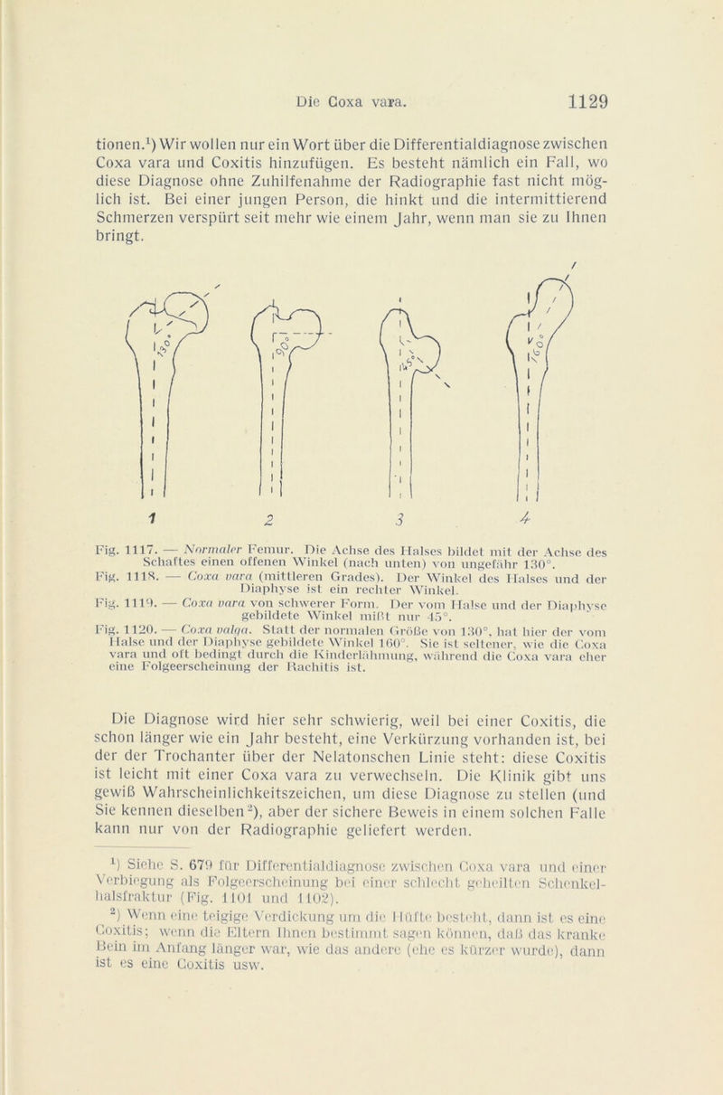 tionen.1) Wir wollen nur ein Wort über die Differentialdiagnose zwischen Coxa vara und Coxitis hinzufügen. Es besteht nâmlich ein Fall, wo diese Diagnose ohne Zuhilfenahme der Radiographie fast nicht mbg- lich ist. Bei einer jungen Person, die hinkt und die intermittierend Schmerzen verspiirt seit mehr wie einem Jahr, wenn man sie zu Ihnen bringt. Fig. 1117. — N or malor Fémur. Die Achse des Halses Dildet mit der Achse des Schaftes einen offenen Winkel (nach unten) von ungefahr 130°. Fig. 111S. — Coxa vara (mittleren Grades). Der Winkel des Halses und der Diaphyse ist ein rechter Winkel. Fig. 1110. — Coxa vara von schwerer Form. Der vom Halse und der Diaphyse gebildete Winkel mifît nur 45°. Fig. 1120. — Coxa valqa. Statt der normalen GrôBe von 130°. hat hier der vom Halse und der Diaphyse gebildete Winkel 160°. Sie isl seltener, wie die Goxa vara und ol't bedingt durch die Kinderlahmung, wahrend die Coxa vara cher eine Folgeerscheinung der Rachitis ist. Die Diagnose wird hier selir schwierig, weil bei einer Coxitis, die schon langer wie ein Jahr besteht, eine Verkürzung vorhanden ist, bei der der Trochanter über der Nelatonschen Linie steht: diese Coxitis ist leicht mit einer Coxa vara zu verwechseln. Die Klinik gibt uns gewib Wahrscheinlichkeitszeichen, uni diese Diagnose zu stellen (und Sie kennen dieselben 2), aber der sichere Beweis in einem solchen Falle kann nur von der Radiographie geliefert werden. x) Siche S. 679 fur Differentialdiagnose zwischen Coxa vara und einer halsfraktur (Fig. 1101 und 1102). ^ 2) Wenn eine teigige Verdickung uni die Hüfte besteht, dann ist es eine Coxitis; wenn die Eltern Ihnen bestimmt sagen kônnen, dafî das kranke B ein un Anfang langer war, wie das andere (ehe es kiirzer wurde), dann ist es eine Coxitis usw. / 1 3