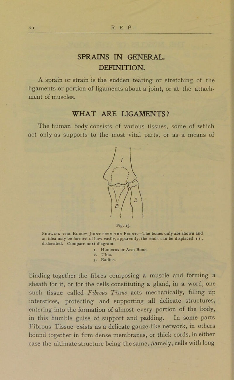 SPRAINS IN GENERAL. DEFINITION. A sprain or strain is the sudden tearing or stretching of the ligaments or portion of ligaments about a joint, or at the attach- ment of muscles. WHAT ARE LIGAMENTS? The human body consists of various tissues, some of which act only as supports to the most vital parts, or as a means of Showing the Klbow Joint from the Front.—The bones only arc shown and an idea may be formed oi how easilVi apparently, the ends can be displaced, dislocated. Compare next diagram. 1. Humerus or Arm Bone. 2. Ulna. 3. Radius. binding together the fibres composing a muscle and forming a sheath for it, or for the cells constituting a glaiid, in a word, one such tissue called Fibrous Tissue acts mechanically, filling up interstices, protecting and supporting all delicate structures, entering into the formation of almost every portion of the body, in this humble guise of support and padding. In some parts Fibrous Tissue exists as a delicate gauze-like network, in others bound together in firm dense membranes, or thick cords, in either case the ultimate structure being the same, namely, cells with long