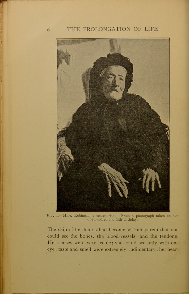 Fig. I.—Mme. Robineau, a centenarian. From a photograph taken on her one hundred and fifth birthday. The skin of lier hands had become so transparent that one could see the bones, the blood-vessels, and the tendons. Her senses were very feeble ; she could see only with one eye; taste and smell were extremely rudimentary ; her hear-