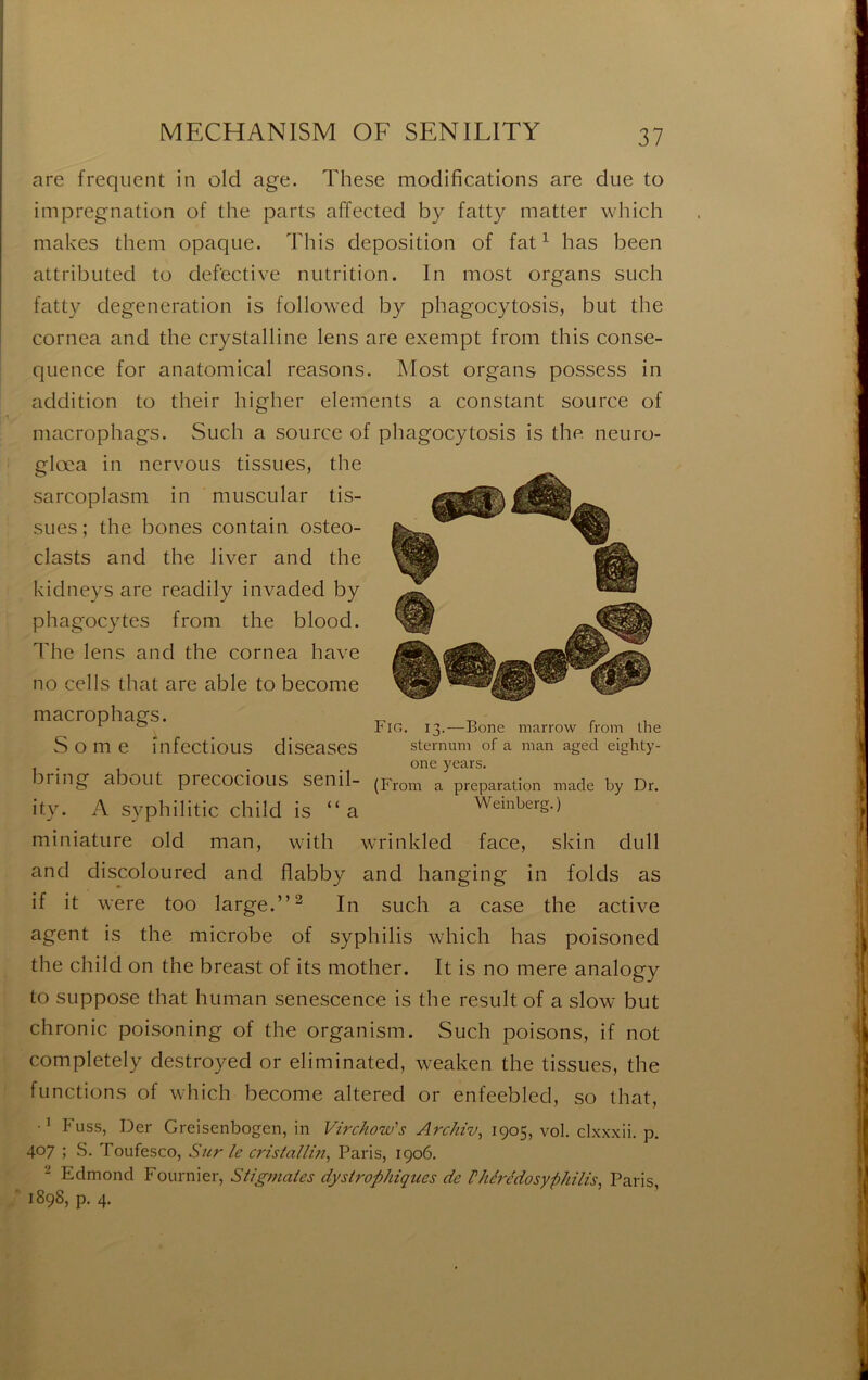 are frequent in old âge. These modifications are due to imprégnation of the parts affected by fatty matter which makes them opaque. This déposition of fat ^ bas been attributed to defective nutrition. In most organs such fatty degeneration is followed by phagocytosis, but the cornea and the crystalline lens are exempt from this consé- quence for anatomical reasons. Most organs possess in addition to their higher éléments a constant source of macrophags. Such a source of phagocytosis is the neiiro- glœa in nervous tissues, the sarcoplasm in muscular tis- sues ; the bones contain osteo- clasts and the liver and the kidneys are readily invaded by phagocytes from the blood. The lens and the cornea hâve no cells that are able to become macrophags. S O m e infections diseases bring about precocious senil- ity. A syphilitic child is “a miniature old man, with wrinkled face, skin dull and discoloured and flabby and hanging in folds as if it were too large.” ^ In such a case the active agent is the microbe of syphilis which lias poisoned the child on the breast of its mother. It is no mere analogy to suppose that human senescence is the resuit of a slow but chronic poisoning of the organism. Such poisons, if not completely destroyed or eliminated, weaken the tissues, the functions of w3iich become altered or enfeebled, so that, Fuss, Der Greisenbogen, in Virchow's Archiv^ 1905, vol. clxxxii. p. 407 ; S. Toufesco, Sur le cristallm^ Paris, 1906. 2 Edmond Fournier, Stigmates dystrophiques de ritérédosyphilis, Paris, 1898, p. 4. Fig. 13.—Bone marrow from the sternum of a man aged eighty- one years. (From a préparation made by Dr. Weinberg.)