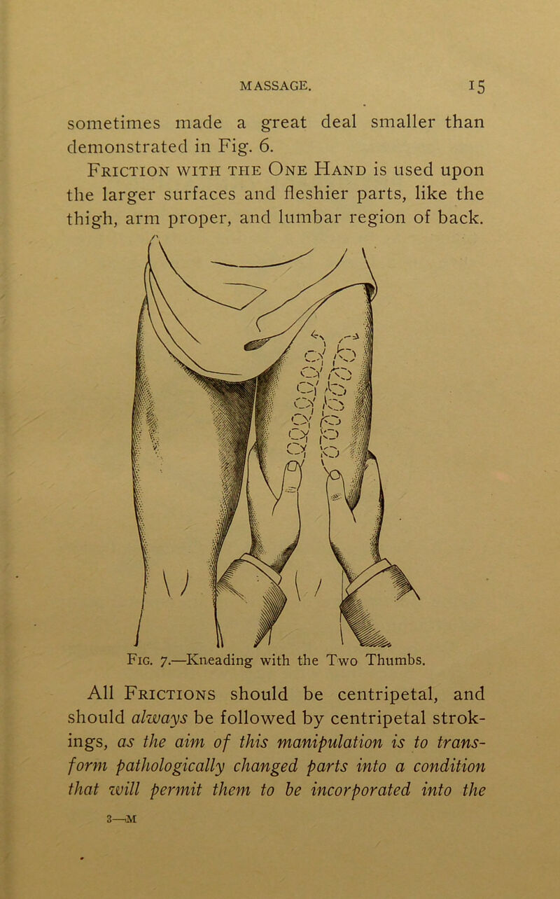 sometimes made a great deal smaller than demonstrated in Fig. 6. Friction with the One Hand is used upon the larger surfaces and fleshier parts, like the thigh, arm proper, and lumbar region of back. All Frictions should be centripetal, and should always be followed by centripetal strok- ings, as the aim of this manipulation is to trans- form pathologically changed parts into a condition that will permit them to be incorporated into the 3—>M