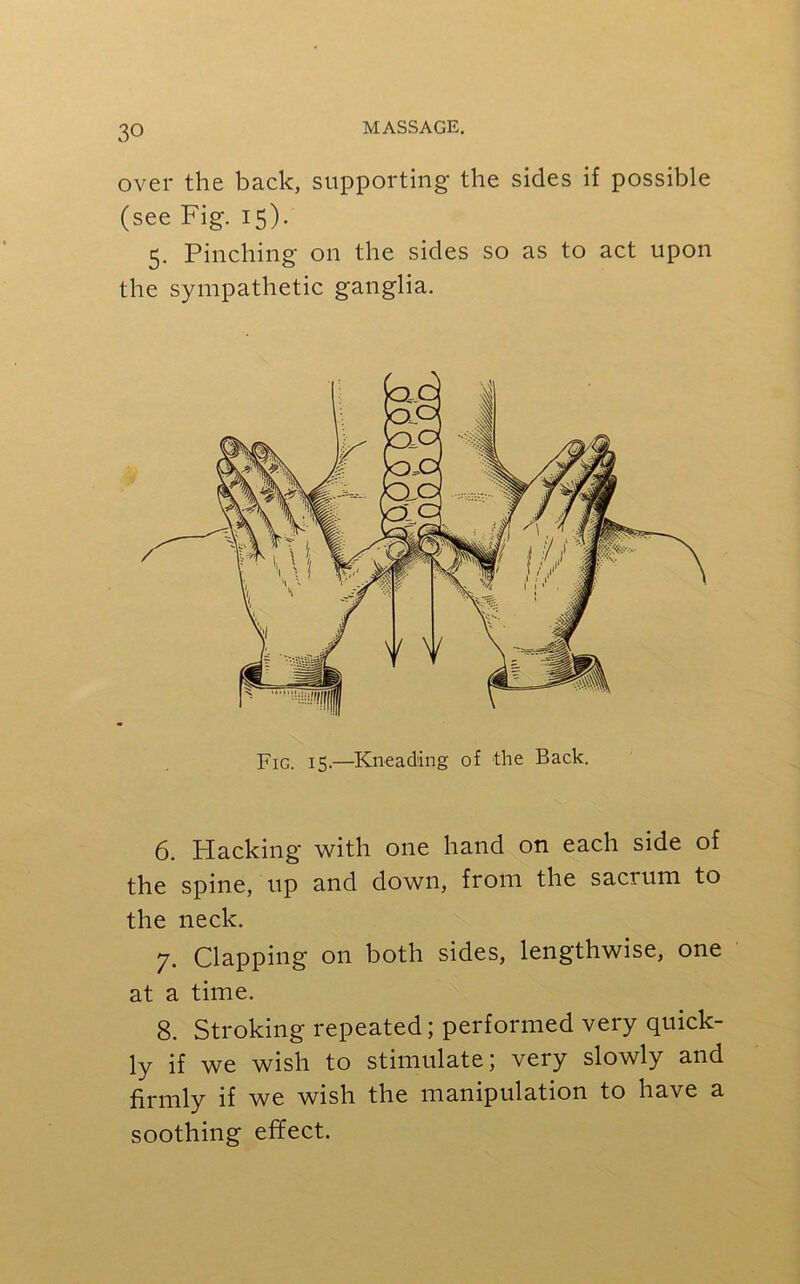 over the back, supporting the sides if possible (see Fig. 15). 5. Pinching on the sides so as to act upon the sympathetic ganglia. Fig. 15.—Kneading of the Back. 6. Hacking with one hand on each side of the spine, up and down, from the sacrum to the neck. 7. Clapping on both sides, lengthwise, one at a time. 8. Stroking repeated; performed very quick- ly if we wish to stimulate; very slowly and firmly if we wish the manipulation to have a soothing effect.