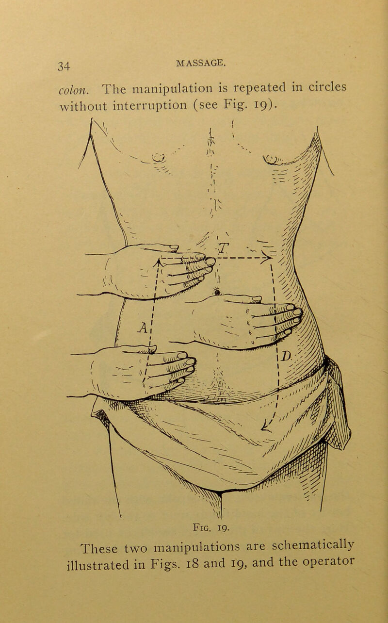 colon. The manipulation is repeated in circles without interruption (see Fig. 19). These two manipulations are schematically illustrated in Figs. 18 and 19* the opeiatoi