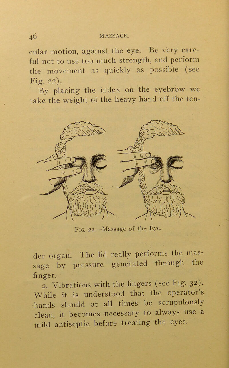 cular motion, against the eye. Be very care- ful not to use too much strength, and perform the movement as quickly as possible (see Fig. 22). By placing the index on the eyebrow we take the weight of the heavy hand off the ten- Fig. 22.—Massage of the Eye. der organ. The lid really perfoims the mas sage by pressure generated through the finger. 2. Vibrations with the fingers (see Fig. 32). While it is understood that the operator’s hands should at all times be scrupulously clean, it becomes necessary to always use a mild antiseptic before treating the eyes.