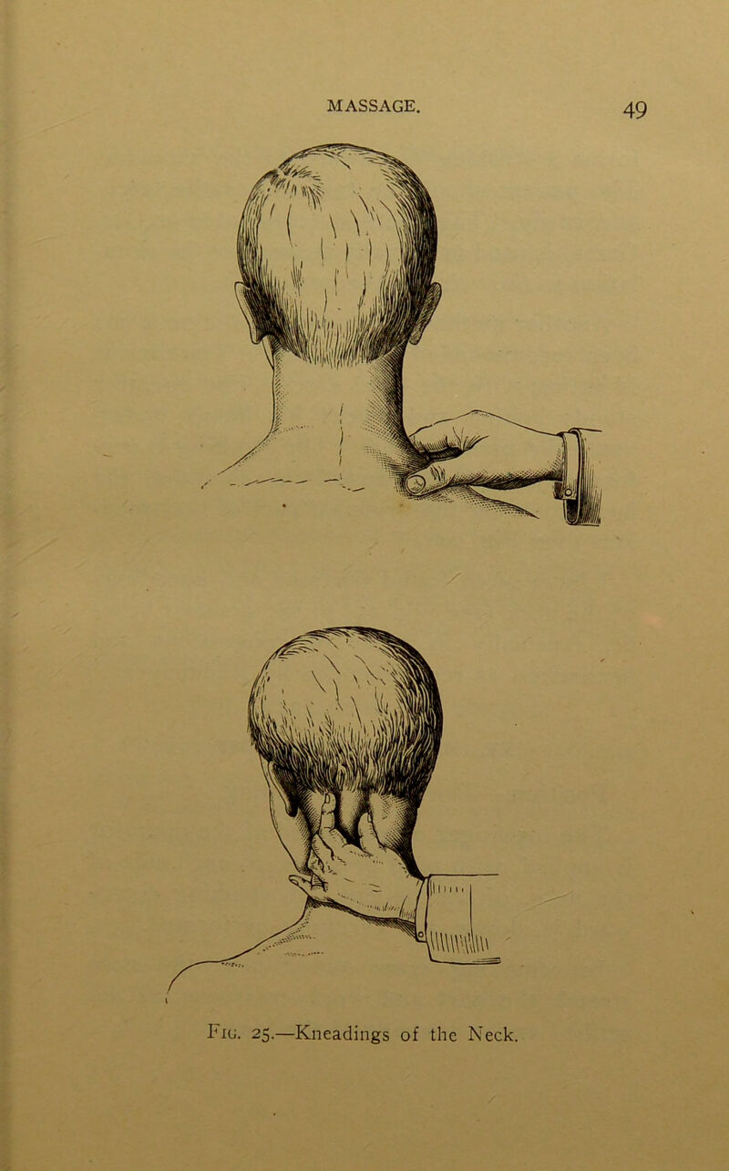 Pig. 25.—Kneadings of the Neck.