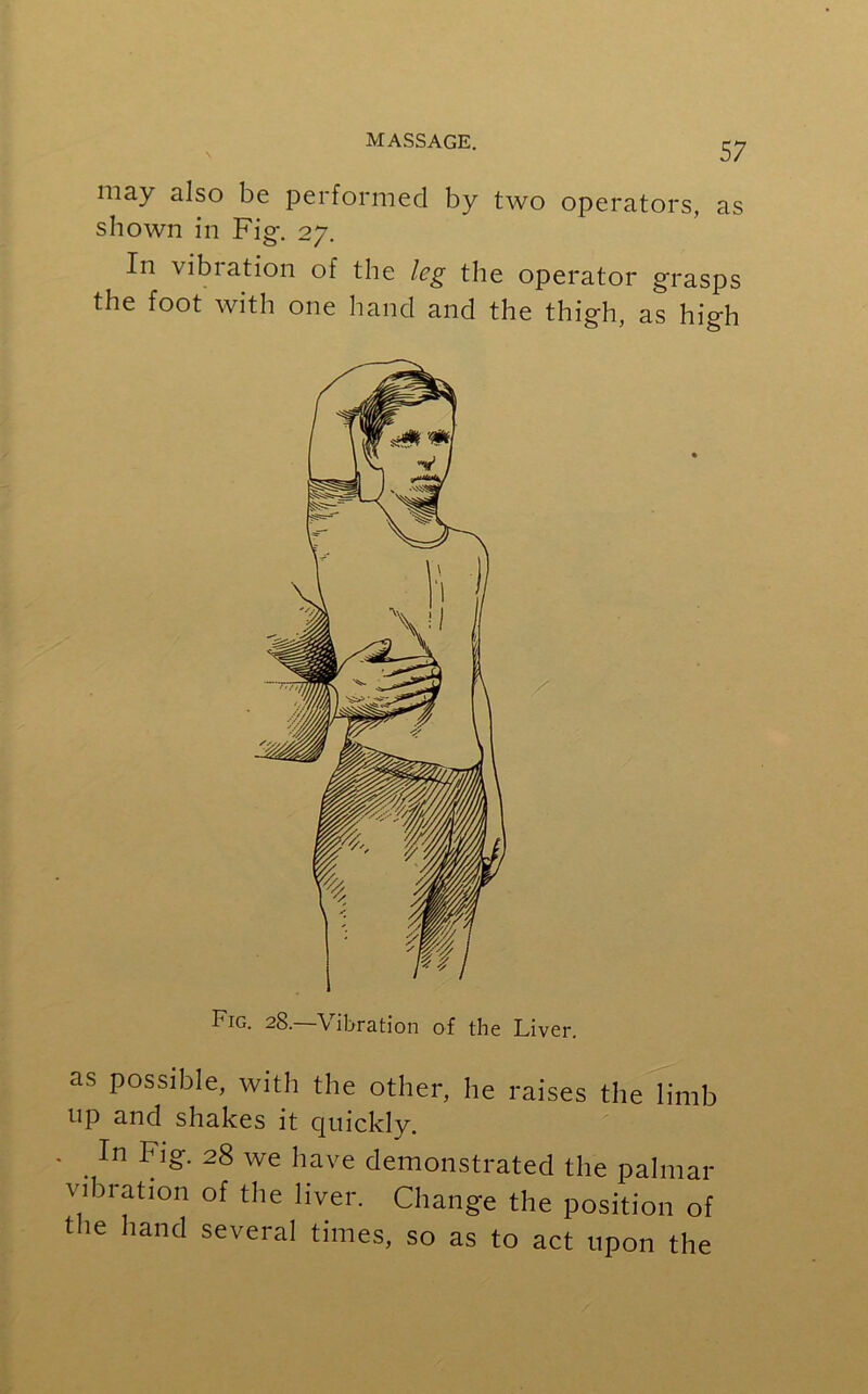 may also be performed by two operators, as shown in Fig. 27. In vibration of the leg the operator grasps the foot with one hand and the thigh, as high as possible, with the other, he raises the limb up and shakes it quickly. . In Fig. 28 we have demonstrated the palmar vibration of the liver. Change the position of the hand several times, so as to act upon the