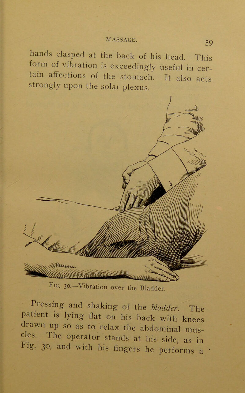 59 hands clasped at the back of his head. This foim of vibration is exceedingly useful in cer- tain affections of the stomach. It also acts strongly upon the solar plexus. Fig. 30.—Vibration over the Bladder. Pressing and shaking of the bladder. The patient is lying flat on his back with knees rawn up so as to relax the abdominal mus- cles. The operator stands at his side, as in hig. 30, and with his fingers he performs a '