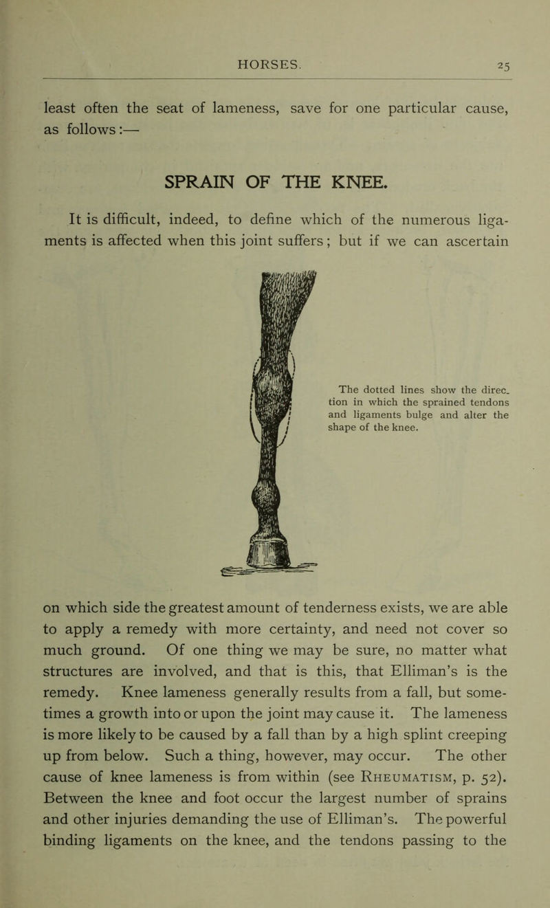 least often the seat of lameness, save for one particular cause, as follows:— It is difficult, indeed, to define which of the numerous liga- ments is affected when this joint suffers; but if we can ascertain on which side the greatest amount of tenderness exists, we are able to apply a remedy with more certainty, and need not cover so much ground. Of one thing we may be sure, no matter what structures are involved, and that is this, that Elliman’s is the remedy. Knee lameness generally results from a fall, but some- times a growth into or upon the joint may cause it. The lameness is more likely to be caused by a fall than by a high splint creeping up from below. Such a thing, however, may occur. The other cause of knee lameness is from within (see Rheumatism, p. 52). Between the knee and foot occur the largest number of sprains and other injuries demanding the use of Elliman’s. The powerful binding ligaments on the knee, and the tendons passing to the SPRAIN OF THE KNEE, The dotted lines show the direc. tion in which the sprained tendons and ligaments bulge and alter the shape of the knee.