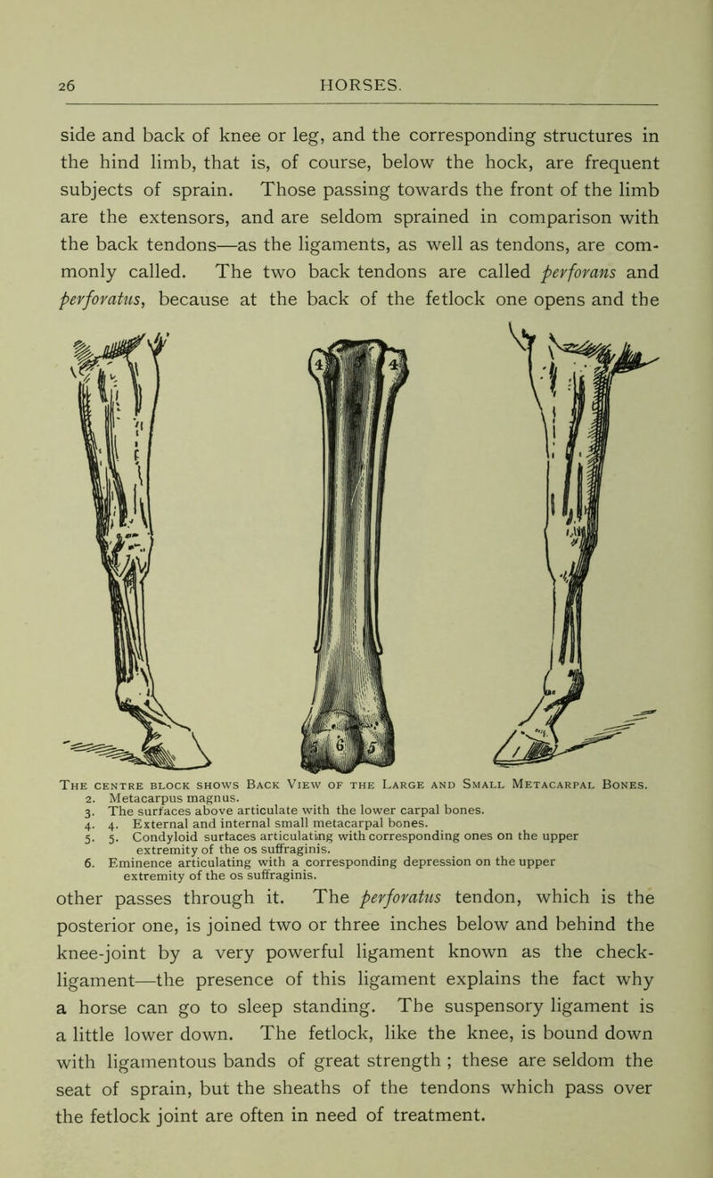 side and back of knee or leg, and the corresponding structures in the hind limb, that is, of course, below the hock, are frequent subjects of sprain. Those passing towards the front of the limb are the extensors, and are seldom sprained in comparison with the back tendons—as the ligaments, as well as tendons, are com- monly called. The two back tendons are called perforans and perforatus, because at the back of the fetlock one opens and the The centre block shows Back View of the Large and Small Metacarpal Bones. 2. Metacarpus magnus. 3. The surfaces above articulate with the lower carpal bones. 4. 4. External and internal small metacarpal bones. 5. 5. Condyloid surfaces articulating with corresponding ones on the upper extremity of the os suffraginis. 6. Eminence articulating with a corresponding depression on the upper extremity of the os suffraginis. other passes through it. The perforatus tendon, which is the posterior one, is joined two or three inches below and behind the knee-joint by a very powerful ligament known as the check- ligament—the presence of this ligament explains the fact why a horse can go to sleep standing. The suspensory ligament is a little lower down. The fetlock, like the knee, is bound down with ligamentous bands of great strength ; these are seldom the seat of sprain, but the sheaths of the tendons which pass over the fetlock joint are often in need of treatment.