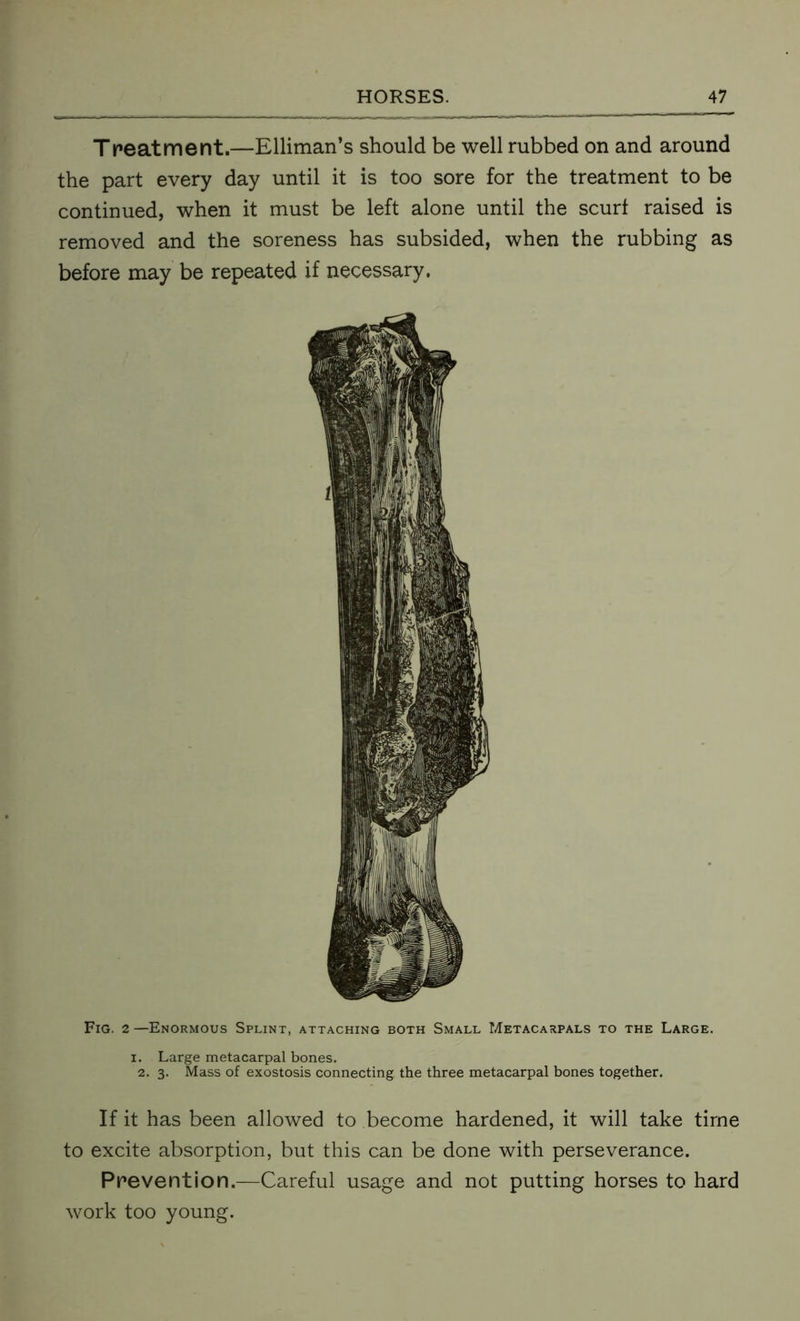 Treatment.—Elliman’s should be well rubbed on and around the part every day until it is too sore for the treatment to be continued, when it must be left alone until the scurf raised is removed and the soreness has subsided, when the rubbing as before may be repeated if necessary, Fig. 2—Enormous Splint, attaching both Small Metacarpals to the Large, i. Large metacarpal bones. 2. 3. Mass of exostosis connecting the three metacarpal bones together. If it has been allowed to become hardened, it will take time to excite absorption, but this can be done with perseverance. Prevention.—Careful usage and not putting horses to hard work too young.