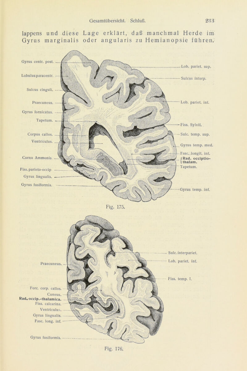 lappens und diese Lage erklärt, daß manchmal Herde im Gyrus marginalis oder angularis zu Hemianopsie führen. Gyrus centr. post. Lobulusparacentr. Sulcus cinguli. Praecuneus. Gyrus fornicatus. Tapetum. Corpus callos. Ventriculus. Cornu Ammonis. Lob. pariet. sup. Sulcus interp. Lob. pariet. int. • Gyrus temp. inf. Fiss. parieto-occip - Gyrus lingualis. — Gyrus fusiformis. -Fiss. Sylvii. • Sulc. temp. sup. . Gyrus temp. med. Fase. Iongit. inf. J Rad. occiptio- l thalam. Tapetum. Fig. 175. Praecuneus. Forc. corp. callos. Cuneus. Rad. occip.-thalamica. Fiss. calcarina. Ventriculus. Gyrus lingualis. Fase. long. inf. Gyrus fusiformis. Sulc. interpariet. Lob. pariet. inf. Fiss. temp. I. Fig. 176,