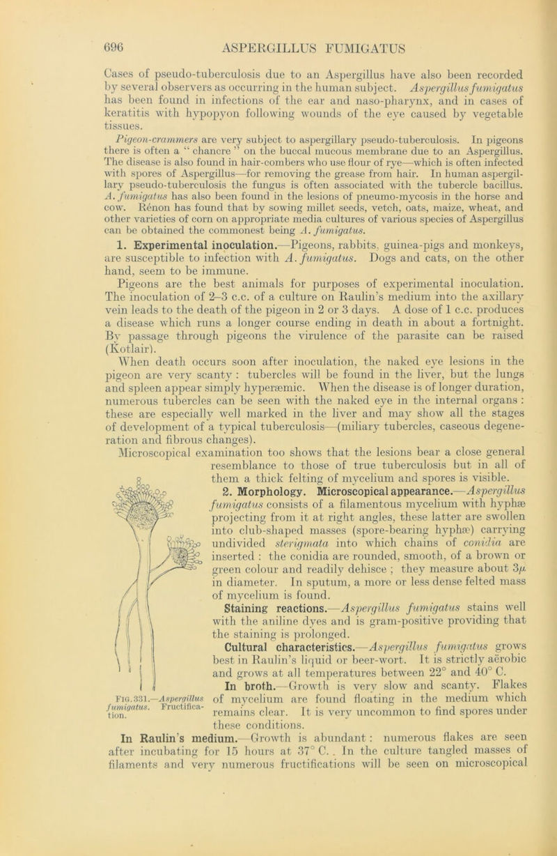 Cases of pseudo-tuberculosis due to an Aspergillus have also been recorded by several observers as occurring in the human subject. Aspergillusfumigatus has been found in infections of the ear and naso-pharynx, and in cases of keratitis with hypopyon following wounds of the eye caused by vegetable tissues. Pigeon-crammers are very subject to aspergillary pseudo-tuberculosis. In pigeons there is often a “ chancre ” on the buccal mucous membrane due to an Aspergillus. The disease is also found in hair-combers who use flour of rye—which is often infected with spores of Aspergillus—for removing the grease from hair. In human aspergil- lary pseudo-tuberculosis the fungus is often associated with the tubercle bacillus. A. fumigatus has also been found in the lesions of pneumo-mycosis in the horse and cow. Renon has found that by sowing millet seeds, vetch, oats, maize, wheat, and other varieties of corn on appropriate media cultures of various species of Aspergillus can be obtained the commonest being A. fumigatus. 1. Experimental inoculation.—Pigeons, rabbits, guinea-pigs and monkeys, are susceptible to infection with A. fumigatus. Dogs and cats, on the other hand, seem to be immune. Pigeons are the best animals for purposes of experimental inoculation. The inoculation of 2-3 c.c. of a culture on Raulin’s medium into the axillary vein leads to the death of the pigeon in 2 or 3 days. A dose of 1 c.c. produces a disease which runs a longer course ending in death in about a fortnight. By passage through pigeons the virulence of the parasite can be raised (Kotlairh When death occurs soon after inoculation, the naked eye lesions in the pigeon are very scanty : tubercles will be found in the liver, but the lungs and spleen appear simply hypersemic. When the disease is of longer duration, numerous tubercles can be seen with the naked eye in the internal organs : these are especially well marked in the liver and may show all the stages of development of a typical tuberculosis—(miliary tubercles, caseous degene- ration and fibrous changes). Microscopical examination too shows that the lesions bear a close general resemblance to those of true tuberculosis but in all of them a thick felting of mycelium and spores is visible. 2. Morphology. Microscopical appearance.—Aspergillus fumigatus consists of a filamentous mycelium with hyphae projecting from it at right angles, these latter are swollen into club-shaped masses (spore-bearing hvpha?) carrying undivided sterigmata into which chains of conidia are inserted : the conidia are rounded, smooth, of a brown or green colour and readily dehisce ; they measure about 3/x in diameter. In sputum, a more or less dense felted mass of mycelium is found. Staining reactions.—Aspergillus fumigatus stains well with the aniline dyes and is gram-positive providing that the staining is prolonged. Cultural characteristics.—Aspergillus fumigatus grows best in Raulin’s liquid or beer-wort. It is strictly aerobic and grows at all temperatures between 22° and 40° C. In broth.—Growth is very slow and scanty. Flakes of mycelium are found floating in the medium which remains clear. It is very uncommon to find spores under these conditions. In Raulin’s medium.—Growth is abundant : numerous flakes are seen after incubating for 15 hours at 37° C. . In the culture tangled masses of filaments and very numerous fructifications will be seen on microscopical 23 Fig.331. fumigatus. tion. Aspergillus Fructifica-