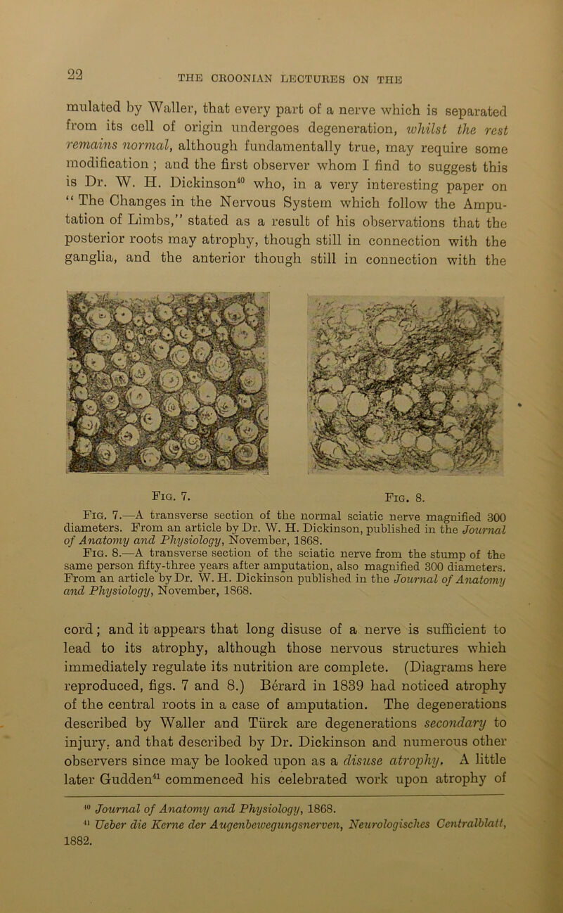 mulated by Waller, that every part of a nerve which is separated from its cell of origin undergoes degeneration, whilst the rest remains normal, although fundamentally true, may require some modification ; and the first observer whom I find to suggest this is Dr. W. H. Dickinson40 who, in a very interesting paper on “ The Changes in the Nervous System which follow the Ampu- tation of Limbs,” stated as a result of his observations that the posterior roots may atrophy, though still in connection with the ganglia, and the anterior though still in connection with the Fig. 7. Fig. 8. Fig. 7.—A transverse section of the normal sciatic nerve magnified 300 diameters. From an article by Dr. W. H. Dickinson, published in the Journal of Anatomy and Physiology, November, 1868. Fig. 8.—A transverse section of the sciatic nerve from the stump of the same person fifty-three years after amputation, also magnified 300 diameters. From an article by Dr. W. H. Dickinson published in the Journal of Anatomy and Physiology, November, 1868. cord; and it appears that long disuse of a nerve is sufficient to lead to its atrophy, although those nervous structures which immediately regulate its nutrition are complete. (Diagrams here reproduced, figs. 7 and 8.) Berard in 1839 had noticed atrophy of the central roots in a case of amputation. The degenerations described by Waller and Tfirck are degenerations secondary to injury, and that described by Dr. Dickinson and numerous other observers since may be looked upon as a disuse atrophy. A little later Gudden41 commenced his celebrated work upon atrophy of 10 Journal of Anatomy and Physiology, 1868. 41 TJeber die Kerne der Augenbciuegungsnervcn, Neurologisches Centralblatt, 1882.