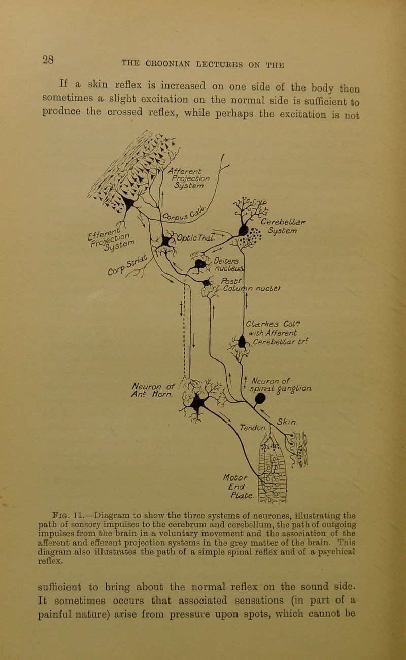 THE CROONIAN LECTURES ON THE If a skin reflex is increased on one side of the body then sometimes a slight excitation on the normal side is sufficient to pioduce the crossed reflex, while perhaps the excitation is not Fig. 11.—Diagram to show the three systems of neurones, illustrating the path of sensory impulses to the cerebrum and cerebellum, the path of outgoing impulses from the brain in a voluntary movement and the association of the afferent and efferent projection systems in the grey matter of the brain. This diagram also illustrates the path of a simple spinal reflex and of a psychical reflex. sufficient to bring about the normal reflex on the sound side. It sometimes occurs that associated sensations (in part of a painful nature) arise from pressure upon spots, which cannot be