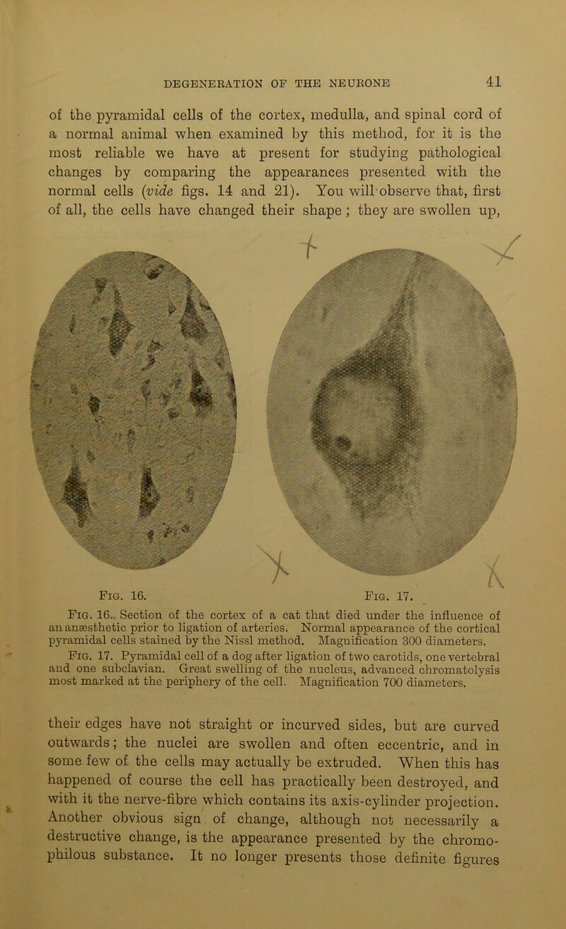 of the pyramidal cells of the cortex, medulla, and spinal cord of a normal animal when examined by this method, for it is the most reliable we have at present for studying pathological changes by comparing the appearances presented with the normal cells (vide figs. 14 and 21). You will observe that, first of all, the cells have changed their shape ; they are swollen up, Pig. 16. Fig. 17. Fig. 16. Section of the cortex of a cat that died under the influence of an anaesthetic prior to ligation of arteries. Normal appearance of the cortical pyramidal cells stained by the Nissl method. Magnification 300 diameters. Fig. 17. Pyramidal cell of a dog after ligation of two carotids, one vertebral and one subclavian. Great swelling of the nucleus, advanced chromatolysis most marked at the periphery of the cell. Magnification 700 diameters. their edges have not straight or incurved sides, but are curved outwards; the nuclei are swollen and often eccentric, and in some few of the cells may actually be extruded. When this has happened of course the cell has practically been destroyed, and with it the nerve-fibre which contains its axis-cylinder projection. Another obvious sign of change, although not necessarily a destructive change, is the appearance presented by the chromo- philous substance. It no longer presents those definite figures