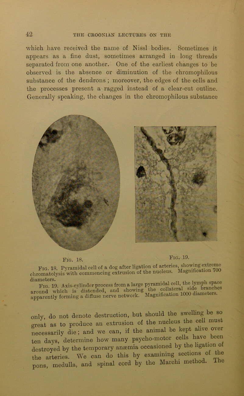 which have received the name of Nissl bodies. Sometimes it appears as a fine dust, sometimes arranged in long threads separated from one another. One of the earliest changes to be observed is the absence or diminution of the chromophilous substance of the dendrons ; moreover, the edges of the cells and the processes present a ragged instead of a clear-cut outline. Generally speaking, the changes in the chromophilous substance Fig. 18. Fig. 19. Fig. 18. Pyramidal cell of a dog after ligation of arteries, showing extreme chromatolysis with commencing extrusion of the nucleus. Magmficatio diameters. . . Fig. 19. Axis-cylinder process from a large pyramidalcell,,the.Z^ranSes around which is distended, and showing the coUateial sade b^ apparently forming a diffuse nerve network. Magnification 1000 diameters. only, do not denote destruction, but should the swelling be so great as to produce an extrusion of the nucleus the cell mus necessarily die; and we can, if the animal be kept alive over ten days, determine how many psycho-motor cells have been destroyed by the temporary anaemia occasioned by the ligation o the arteries. We can do this by examining sections of the pons, medulla, and spinal cord by the Marchi method. Tie