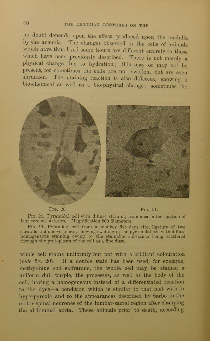 THE CROONIAN LECTURES ON THE no doubt depends upon the effect produced upon the medulla by the anaemia. The changes observed in the cells of animals which have thus lived some hours are different entirely to those which have been previously described. There is not merely a physical change due to hydration ; this may or may not be present, for sometimes the cells are not swollen, but are even shiunken. The staining reaction is also different, showing a bio-chemical as well as a bio-physical change; sometimes the Fig. 20. Fig. 21. Fig. 20. Pyramidal cell with diffuse staining from a cat after ligation of four cerebral arteries. Magnification 500 diameters. Fig. 21. Pyramidal cell from a monkey five days after ligature of two carotids and one vertebral, showing swelling in the pyramidal cell with diffuse homogeneous staining owing to the stainable substance being scattered through the protoplasm of the cell as a fine dust. whole cell stains uniformly but not with a brilliant colouration (vide fig. 20). If a double stain has been used, for example, methyl-blue and • saffranine, the whole cell may be stained a uniform dull purple, the processes, as well as the body of the cell, having a homogeneous instead of a differentiated reaction to the dyes—a condition which is similar to that met with in hyperpyrexia and to the appearances described by Sarbo in the motor-spinal neurones of the lumbar-sacral region after clamping the abdominal aorta. These animals prior to death, according