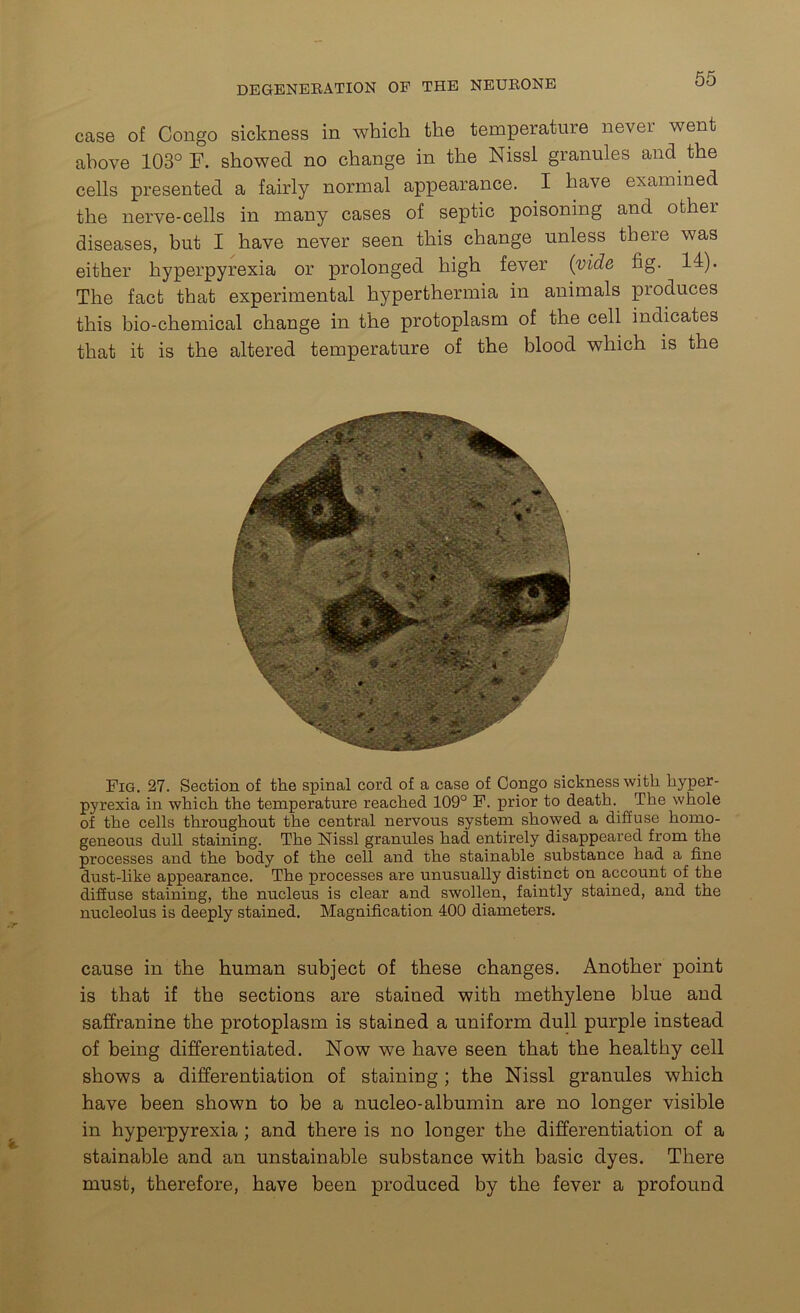 case of Congo sickness in which the temperature never went above 103° F. showed no change in the Nissl granules and the cells presented a fairly normal appearance. I have examined the nerve-cells in many cases of septic poisoning and other diseases, but I have never seen this change unless there was either hyperpyrexia or prolonged high fever (vide fig. 14). The fact that experimental hyperthermia in animals produces this bio-chemical change in the protoplasm of the cell indicates that it is the altered temperature of the blood which is the Fig. 27. Section of the spinal cord of a case of Congo sickness with hyper- pyrexia in which the temperature reached 109° F. prior to death. The whole of the cells throughout the central nervous system showed a diffuse homo- geneous dull staining. The Nissl granules had entirely disappeared from the processes and the body of the cell and the stainable substance had a fine dust-like appearance. The processes are unusually distinct on account of the diffuse staining, the nucleus is clear and swollen, faintly stained, and the nucleolus is deeply stained. Magnification 400 diameters. cause in the human subject of these changes. Another point is that if the sections are stained with methylene blue and saffranine the protoplasm is stained a uniform dull purple instead of being differentiated. Now we have seen that the healthy cell shows a differentiation of staining ; the Nissl granules which have been shown to be a nucleo-albumin are no longer visible in hyperpyrexia ; and there is no longer the differentiation of a stainable and an unstainable substance with basic dyes. There must, therefore, have been produced by the fever a profound