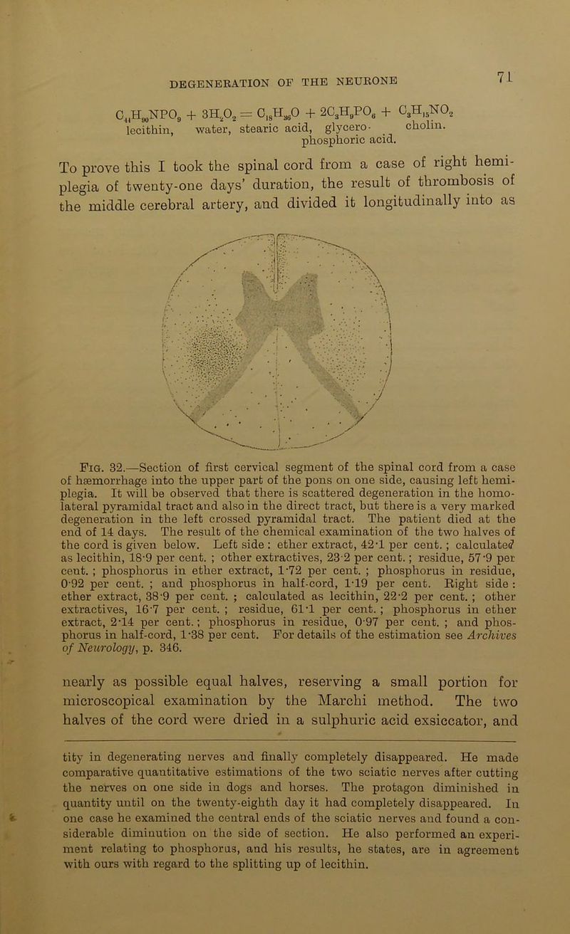 C^H^NPOg + 3H,02= C18HaB0 -f 2CSHBP06 + C3H)5N02 lecithin, water, stearic acid, glycero- _ cholin. phosphoric acid. To prove this I took the spiral cord from a case of right hemi- plegia of twenty-one days’ duration, the result of thrombosis of the middle cerebral artery, and divided it longitudinally into as Fig. 32.—Section of first cervical segment of the spinal cord from a case of hsemorrhage into the upper part of the pons on one side, causing left hemi- plegia. It will be observed that there is scattered degeneration in the homo- lateral pyramidal tract and also in the direct tract, but there is a very marked degeneration in the left crossed pyramidal tract. The patient died at the end of 14 days. The result of the chemical examination of the two halves of the cord is given below. Left side : ether extract, 42 T per cent. ; calculated as lecithin, 18'9 per cent. ; other extractives, 23 2 per cent.; residue, 57 '9 per cent. ; phosphorus in ether extract, 1-72 per cent. ; phosphorus in residue, 092 per cent. ; and phosphorus in half-cord, 1-19 per cent. Right side : ether extract, 38-9 per cent. ; calculated as lecithin, 22-2 per cent. ; other extractives, 16-7 per cent. ; residue, 61T per cent. ; phosphorus in ether- extract, 2-14 per cent.; phosphorus in residue, 0 97 per cent. ; and phos- phorus in half-cord, l-38 per cent. For details of the estimation see Archives of Neurology, p. 346. nearly as possible equal halves, reserving a small portion for microscopical examination by the Marchi method. The two halves of the cord were dried in a sulphuric acid exsiccator, and tity in degenerating nerves and finally completely disappeared. He made comparative quantitative estimations of the two sciatic nerves after cutting the nerves on one side in dogs and horses. The protagon diminished in quantity until on the twenty-eighth day it had completely disappeared. In one case he examined the central ends of the sciatic nerves and found a con- siderable diminution on the side of section. He also performed an experi- ment relating to phosphorus, and his results, he states, are in agreement with ours with regard to the splitting up of lecithin.