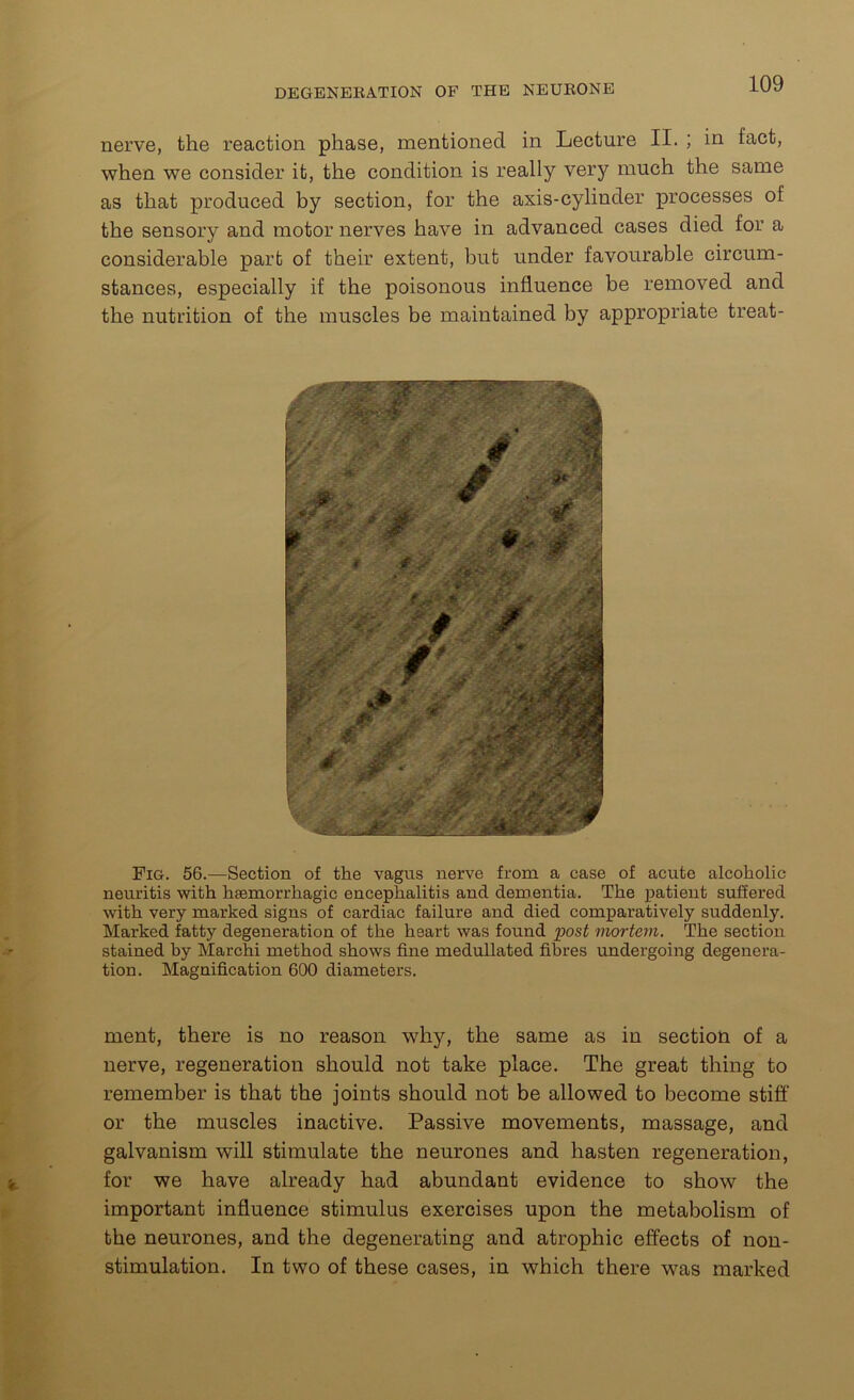 nerve, the reaction phase, mentioned in Lecture II. ; in fact, when we consider it, the condition is really very much the same as that produced by section, for the axis-cylinder processes of the sensory and motor nerves have in advanced cases died for a considerable part of their extent, but under favourable circum- stances, especially if the poisonous influence be removed and the nutrition of the muscles be maintained by appropriate treat- r - ' f. W f- -Iff 0 / # * 4# it ' fM K 0 u Fig. 56.—Section of the vagus nerve from a case of acute alcoholic neuritis with haemorrhagic encephalitis and dementia. The patient suffered with very marked signs of cardiac failure and died comparatively suddenly. Marked fatty degeneration of the heart was found post mortem. The section stained by March! method shows fine medullated fibres undergoing degenera- tion. Magnification 600 diameters. ment, there is no reason why, the same as in section of a nerve, regeneration should not take place. The great thing to remember is that the joints should not be allowed to become stiff or the muscles inactive. Passive movements, massage, and galvanism will stimulate the neurones and hasten regeneration, for we have already had abundant evidence to show the important influence stimulus exercises upon the metabolism of the neurones, and the degenerating and atrophic effects of non- stimulation. In two of these cases, in which there was marked