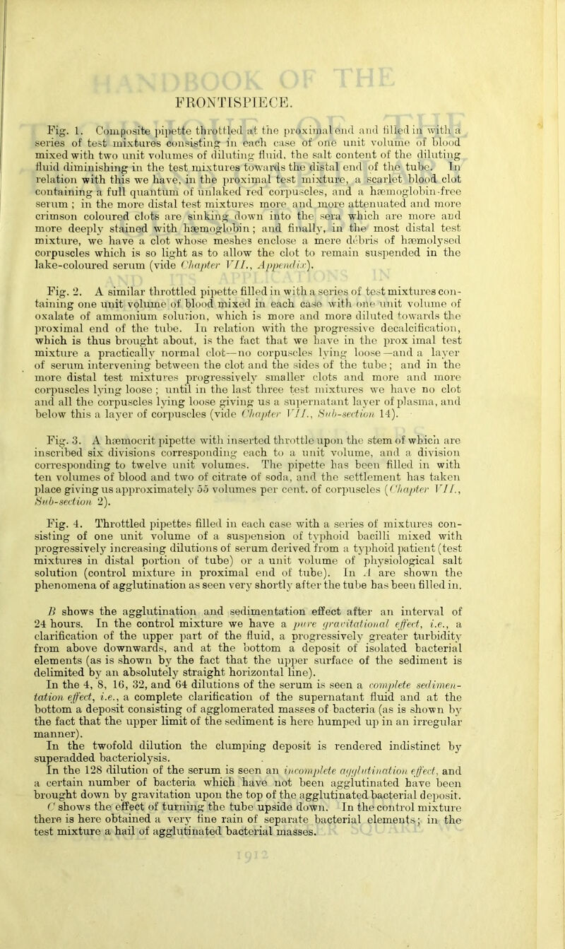 FRONTISPIECE. Fig. 1. Composite pipette throttled aft the proximal end and filled in with a series of test mixtures consisting in each case of one unit volume of hlood mixed with two unit volumes of diluting fluid, the salt content of the diluting fluid diminishing in the test mixtures towards the distal end of the tube. In relation with this we have, in the proximal test mixture, a scarlet hlood clot containing a full quantum of unlaked red corpuscles, and a haemoglobin -free serum ; in the more distal test mixtures more and more attenuated and more crimson coloured clots are sinking down into the sera which are more and more deeply stained with haemoglobin; and finally, in the most distal test mixture, we have a clot whose meshes enclose a mere debris of haemolysed corpuscles which is so light as to allow the clot to remain suspended in the lake-coloured serum (vide Chapter VII., Appendix). Fig. 2. A similar throttled pipette filled in with a series of test mixtures con- taining one unit volume of blood mixed in each case with one unit volume of oxalate of ammonium solution, which is more and more diluted towards the proximal end of the tube. In relation with the progressive decalcification, which is thus brought about, is the fact that we have in the prox imal test mixture a practically normal clot—no corpuscles lying loose—and a layer of serum, intervening between the clot and the sides of the tube; and in the more distal test mixtures progressively smaller clots and more and more corpuscles lying loose; until in the last three test mixtures we have no clot and all the corpuscles lying loose giving us a supernatant layer of plasma, and below this a layer of corpuscles (vide Chapter 1 11., Subsection 14). Fig. 3. A luemocrit pipette with inserted throttle upon the stem of which are inscribed six divisions corresponding each to a unit volume, and a division corresponding to twelve unit volumes. The pipette lias been filled in with ten volumes of blood and two of citrate of soda, and the settlement has taken place giving us approximately 55 volumes per cent, of corpuscles (Chapter VII., Sub-section 2). Fig. 4. Throttled pipettes filled in each case with a series of mixtures con- sisting of one unit volume of a suspension of typhoid bacilli mixed with progressively increasing dilutions of serum derived from a typhoid patient (test mixtures in distal portion of tube) or a unit volume of physiological salt solution (control mixture in proximal end of tube). In .1 are shown the phenomena of agglutination as seen very shortly after the tube has been filled in. B shows the agglutination and sedimentation effect after an interval of 24 hours. In the control mixture we have a pure gravitational effect, i.e., a clarification of the upper part of the fluid, a progressively greater turbidity from above downwards, and at the bottom a deposit of isolated bacterial elements (as is shown by the fact that the upper surface of the sediment is delimited by an absolutely straight horizontal line). In the 4, 8, 16, 32, and 64 dilutions of the serum is seen a complete sedimen- tation effect, i.e., a complete clarification of the supernatant fluid and at the bottom a deposit consisting of agglomerated masses of bacteria (as is shown by the fact that the upper limit of the sediment is here humped up in an irregular manner). In the twofold dilution the clumping deposit is rendered indistinct by superadded bacteriolysis. In the 128 dilution of the serum is seen an incomplete ayylutination effect. and a certain number of bacteria which have not been agglutinated have been brought down by gravitation upon the top of the agglutinated bacterial deposit. <' shows the effect of turning the tube upside down. In the control mixture there is here obtained a very fine rain of separate bacterial elements; in the test mixture a hail of agglutinated bacterial masses.