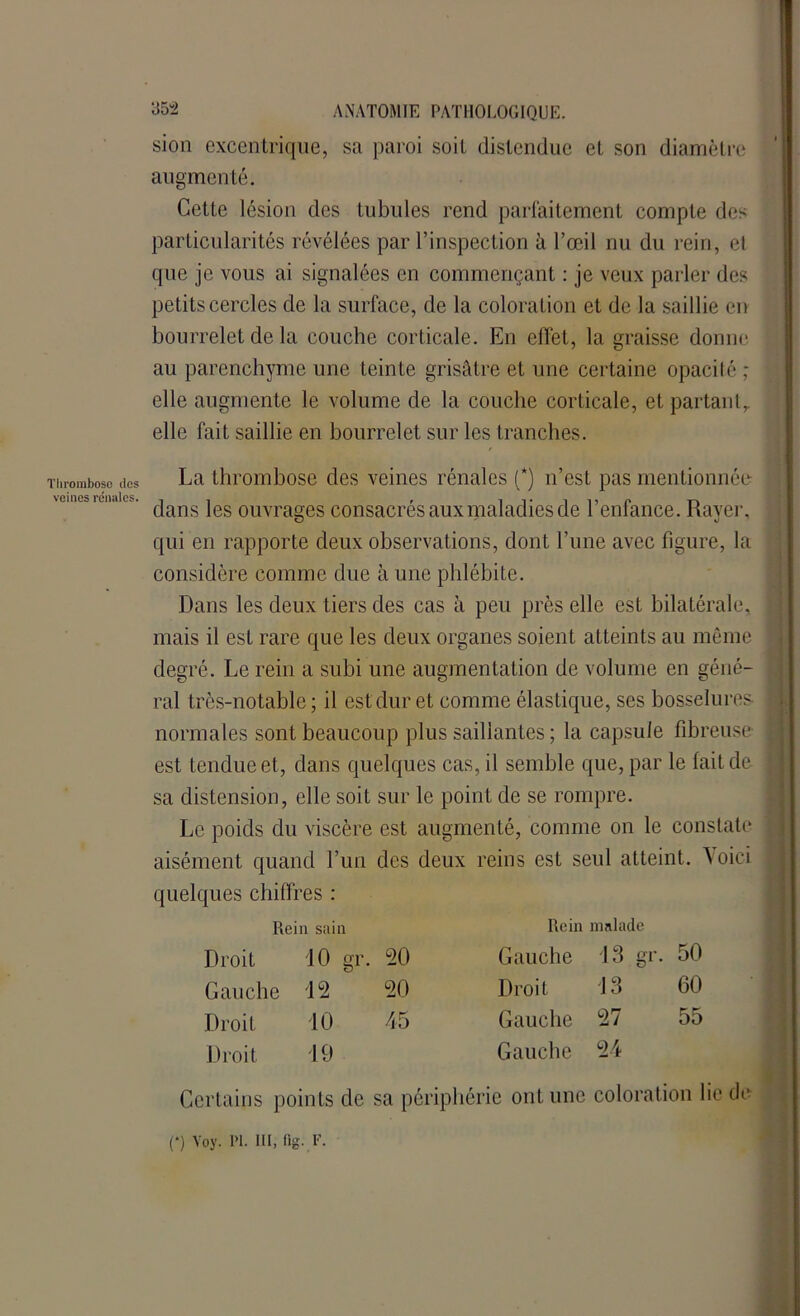 35 “2 sion excentrique, sa paroi soit distendue et son diamètre augmenté. Cette lésion des tubules rend parfaitement compte des particularités révélées par l’inspection à l’œil nu du rein, el que je vous ai signalées en commençant : je veux parler des petits cercles de la surface, de la coloration et de la saillie en bourrelet de la couche corticale. En effet, la graisse donne au parenchyme une teinte grisâtre et une certaine opacité,* elle augmente le volume de la couche corticale, et partantr elle fait saillie en bourrelet sur les tranches. Thrombose des La thrombose des veines rénales (*) n’est pas mentionnée veines rénales. -î-. f t\ clans les ouvrages consacres aux maladies de 1 enlance. Rayer, qui en rapporte deux observations, dont l’une avec figure, la considère comme due à une phlébite. Dans les deux tiers des cas à peu près elle est bilatérale, mais il est rare que les deux organes soient atteints au même degré. Le rein a subi une augmentation de volume en géné- ral très-notable; il est dur et comme élastique, ses bosselures normales sont beaucoup plus saillantes ; la capsule fibreuse est tendue et, dans quelques cas, il semble que, par le fait de sa distension, elle soit sur le point de se rompre. Le poids du viscère est augmenté, comme on le constate aisément quand l’un des deux reins est seul atteint. ^ oici quelques chiffres : Rein sain Rein malade Droit 10 gr. 20 Gauche 13 gr. 50 Gauche to bS O' Droit 13 60 Droit 10 45 Gauche 27 55 Droit 19 Gauche 24 Certains points de sa périphérie ont une coloration lie de