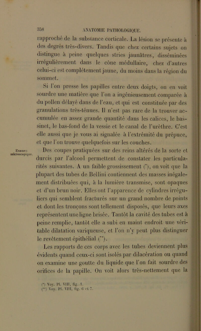 Examen microscopique. ANATOMIE PATHOLOGIQUE, rapproché de la substance corticale. La lésion se présente à des degrés très-divers. Tandis que chez certains sujets on distingue a peine quelques stries jaunâtres, disséminées irrégulièrement dans le cône médullaire, chez d’autres celui-ci est complètement jaune, du moins dans la région du sommet. Si l’on presse les papilles entre deux doigts, on en voit sourdre une matière que l’on a ingénieusement comparée à du pollen délayé dans de l’eau, et qui est constituée par des granulations très-ténues. Il n’est pas rare de la trouver ac- cumulée en assez grande quantité dans les calices, le bas- sinet, le bas-fond de la vessie et le canal de l’urèthre. C’est elle aussi que je vous ai signalée à l’extrémité du prépuce, et que l’on trouve quelquefois sur les couches. Des coupes pratiquées sur des reins altérés de la sorte et durcis par l’alcool permettent de constater les particula- rités suivantes. A un faible grossissement (*), on voit que la plupart des tubes de Bellini contiennent des masses inégale- ment distribuées qui, à la lumière transmise, sont opaques ■et d’un brun noir. Elles ont l’apparence de cylindres irrégu- liers qui semblent fracturés sur un grand nombre de points •et dont les tronçons sont tellement disposés, que leurs axes représentent une ligne brisée. Tantôt la cavité des tubes est à peine remplie, tantôt elle a subi en maint endroit une véri- table dilatation variqueuse, et l’on n’y peut plus distinguer le revêtement épithélial (**). Les rapports de ces corps avec les tubes deviennent plus évidents quand ceux-ci sont isolés par dilacération ou quand on examine une goutte du liquide que l’on fait sourdre des orifices de la papille. On voit alors très-nettement que la (*) Voy. PI. VIII, fig. I. (**) Voy. PI. VIII, fig. 0 et 7.