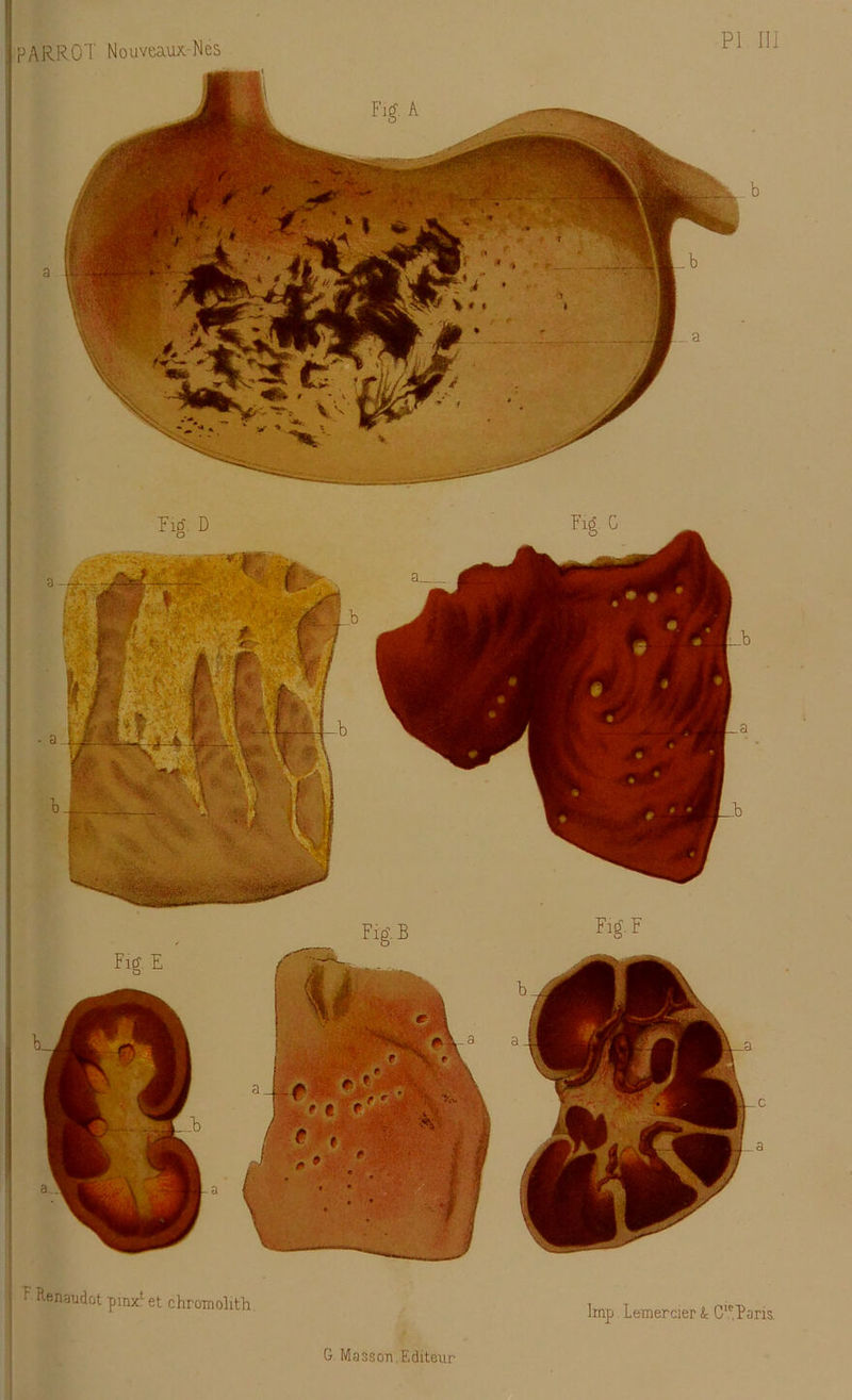 PI III F Renaudot pinxlet chromolith lmp Lemercier & CieParis.