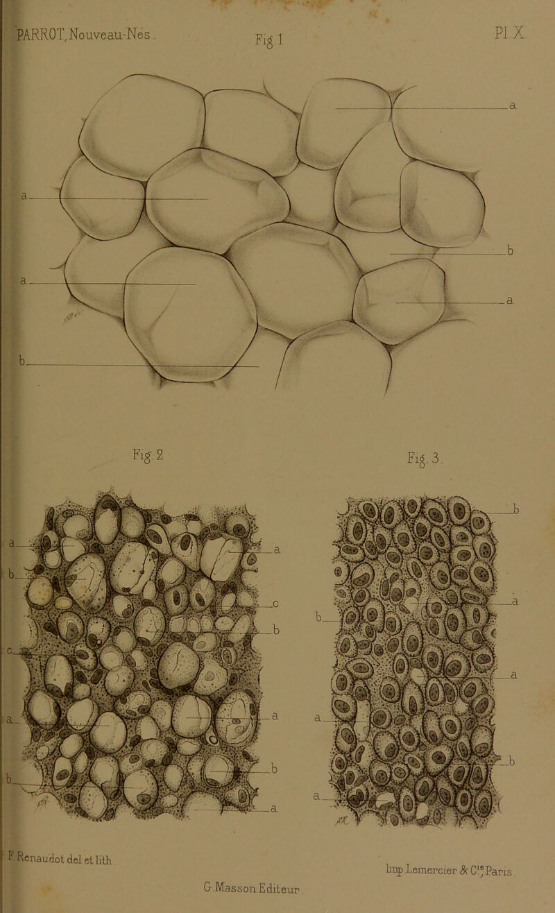 Fig-1 F Renaudot del cllith lmp .Remercier & Cl®Pans