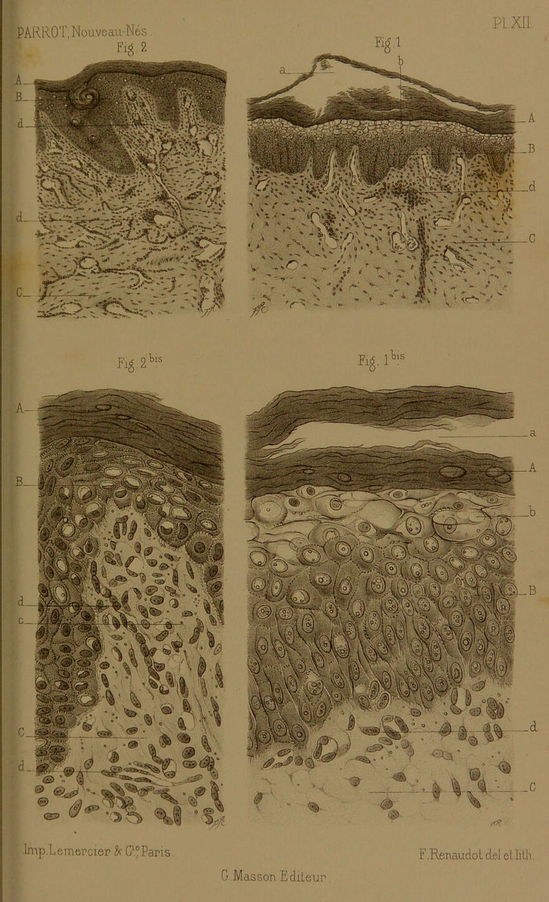 Fig-2 PLXU .■»- O * m ** 4 <r-*' s Kg. 2 bis lmp.Lemercier A G1® Pari s F.Renaudol del etlith.