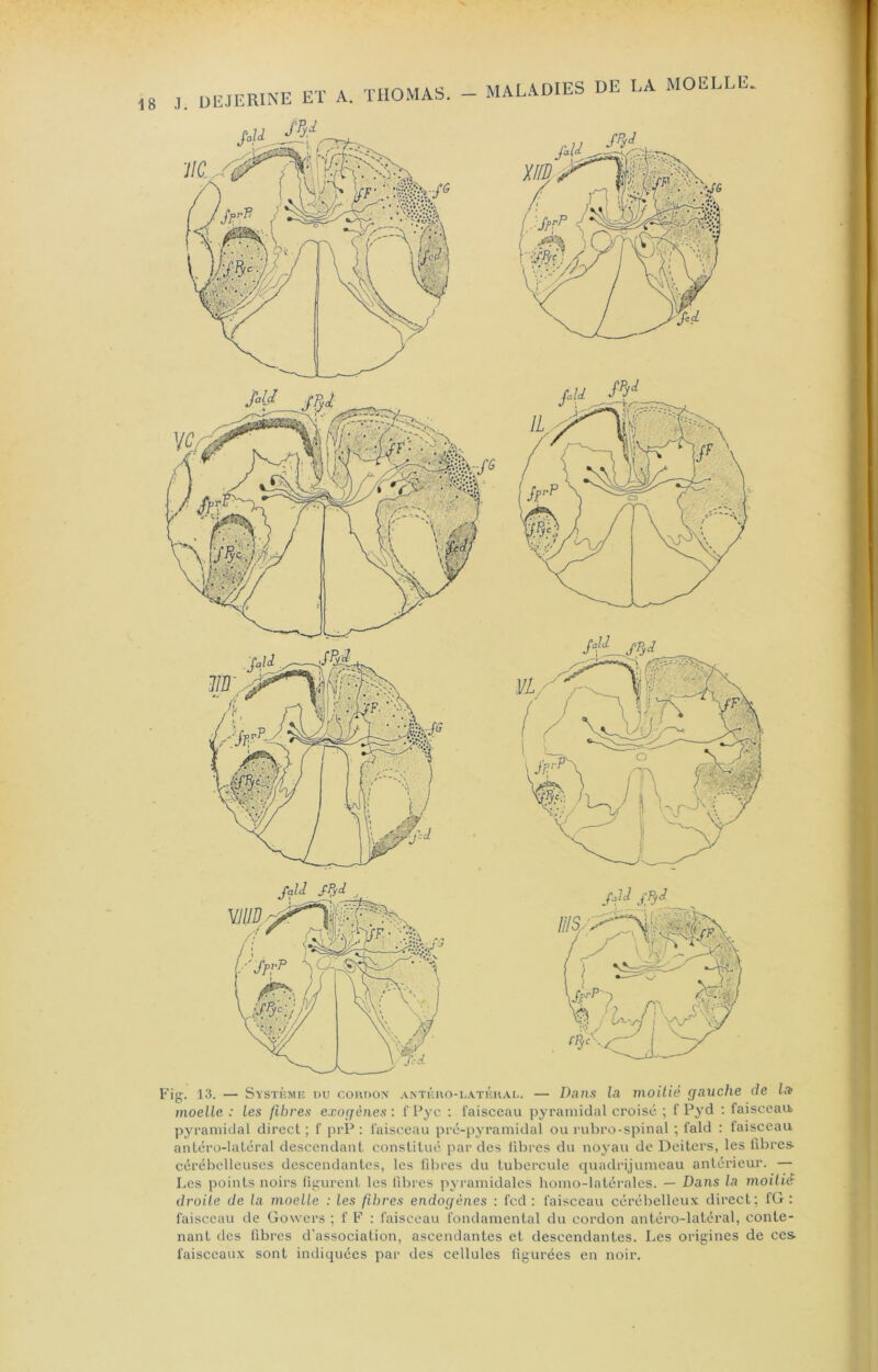 8 J. ÜEJERINE ET A. THOMAS. — MALADIES DE LA MOELLE.. Fig. 13. — Systkme du cohdon antéuo-latéhal. — Dans la moitié gauche de loi moelle : les fibres exogènes : 1' l*yc : faisceau pyramidal croisé ; f Pyd ; faisccaa pyramidal direct ; f prP : faisceau pré-pyramidal ou rubro-spinal ; fald : faisceau antéro-latéral descendant constitué par des libres du noyau de Deiters, les fibres- cérébelleuses descendantes, les filires du tubercule quadrijumeau antérieur. — Les points noirs figurent les libres pyramidales homo-latéralcs. — Dans la moitié droite de la moelle : les fibres endogènes : fcd ; faisceau cérébelleux direct; fG : faisceau de Gowcrs ; f F : faisceau fondamental du cordon antéro-latéral, conte- nant des fibres d’association, ascendantes et descendantes. Les origines de ces faisceaux sont indiquées par des cellules figurées en noir.